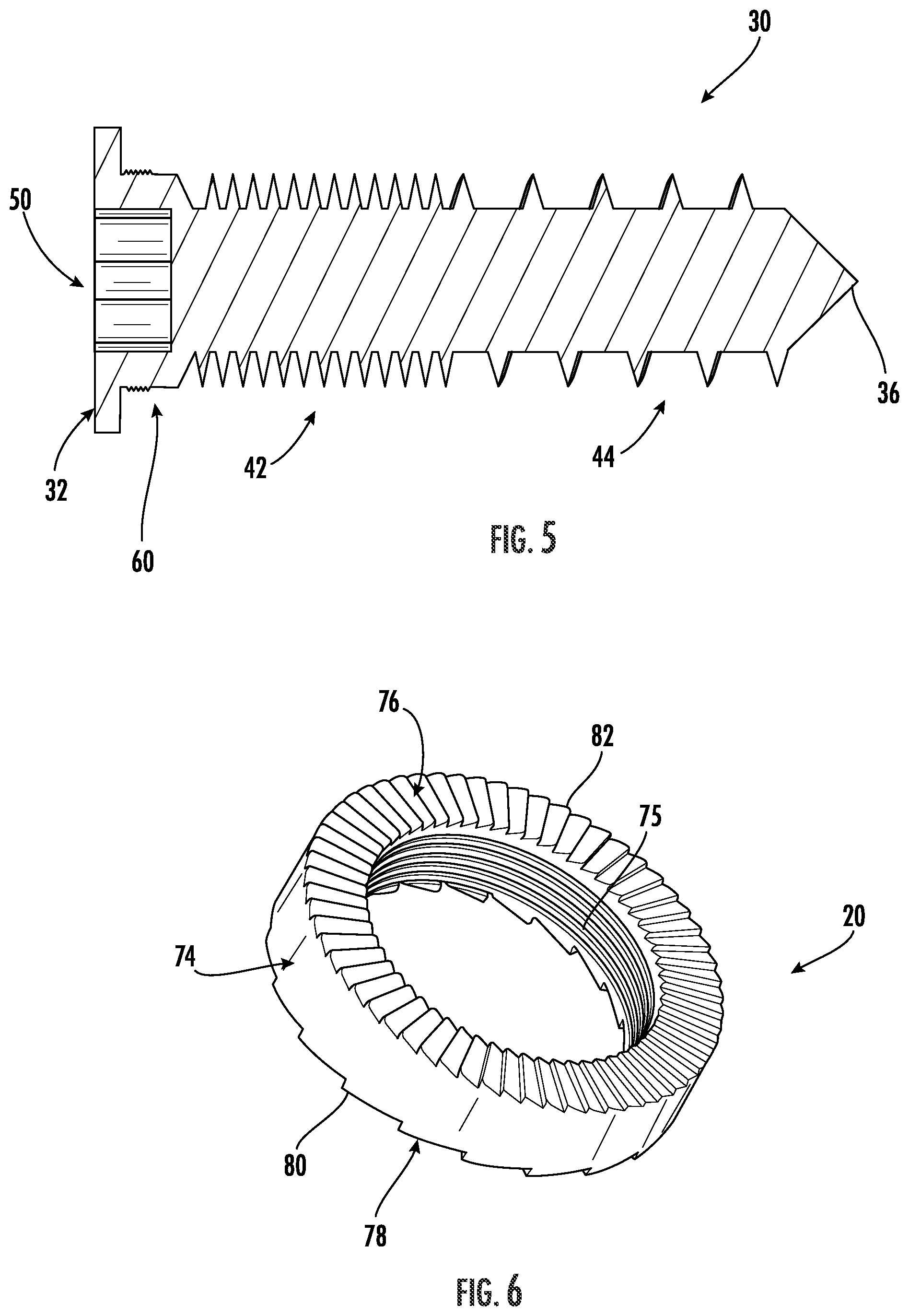 Patent US12551251 Figure 4 – Fixation assemblies for medical implants