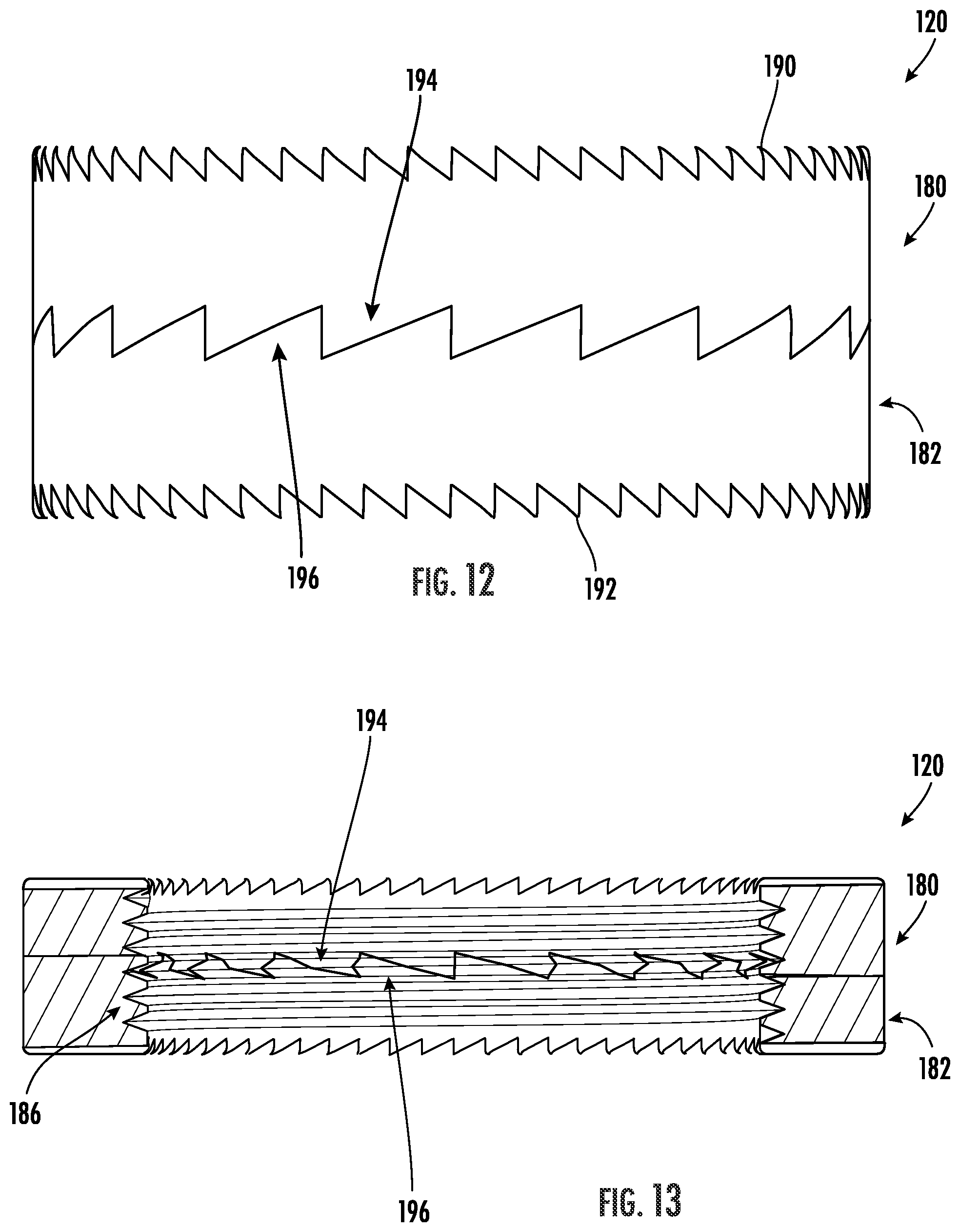 Patent US12551251 Figure 9 – Fixation assemblies for medical implants