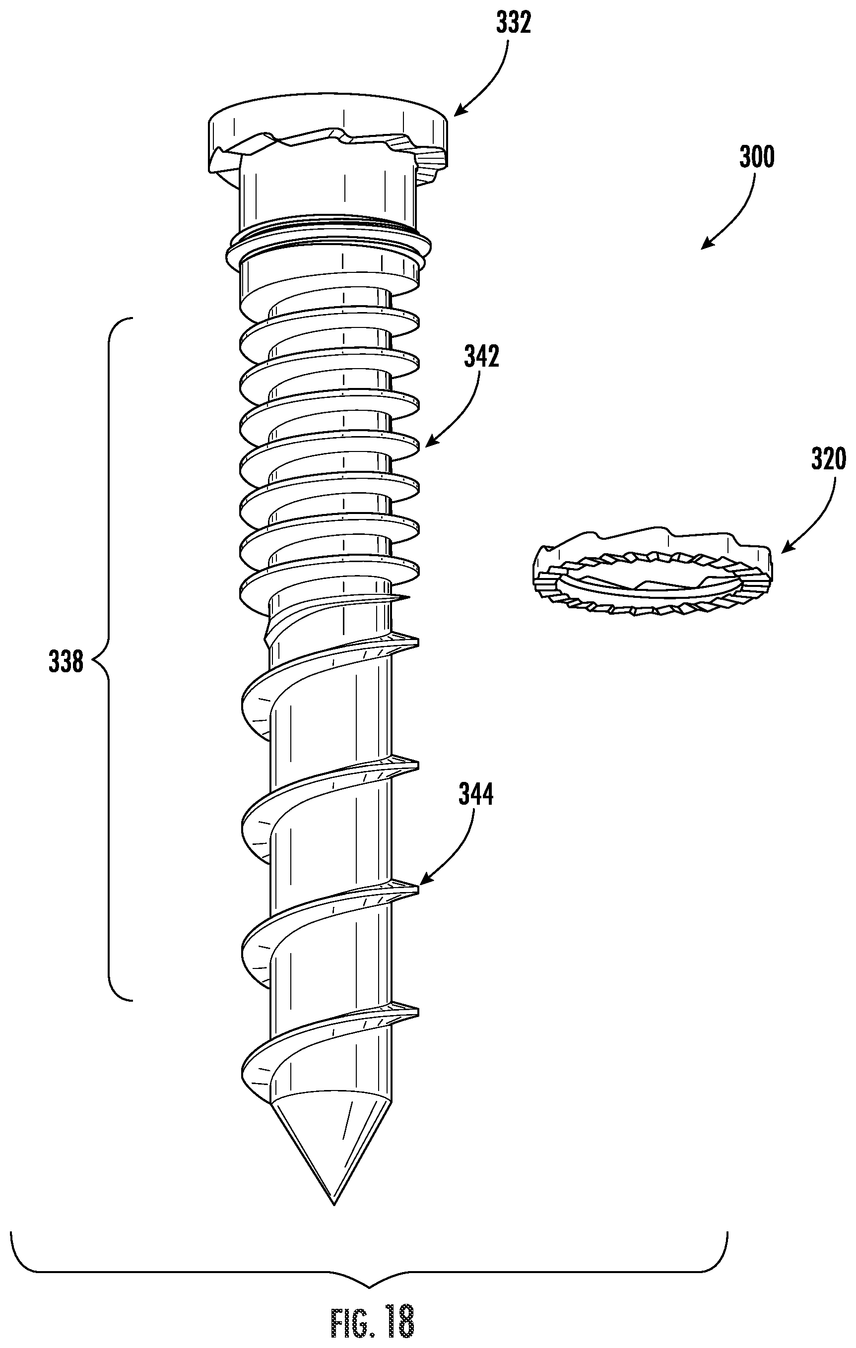 Patent US12551251 Figure 13 – Fixation assemblies for medical implants