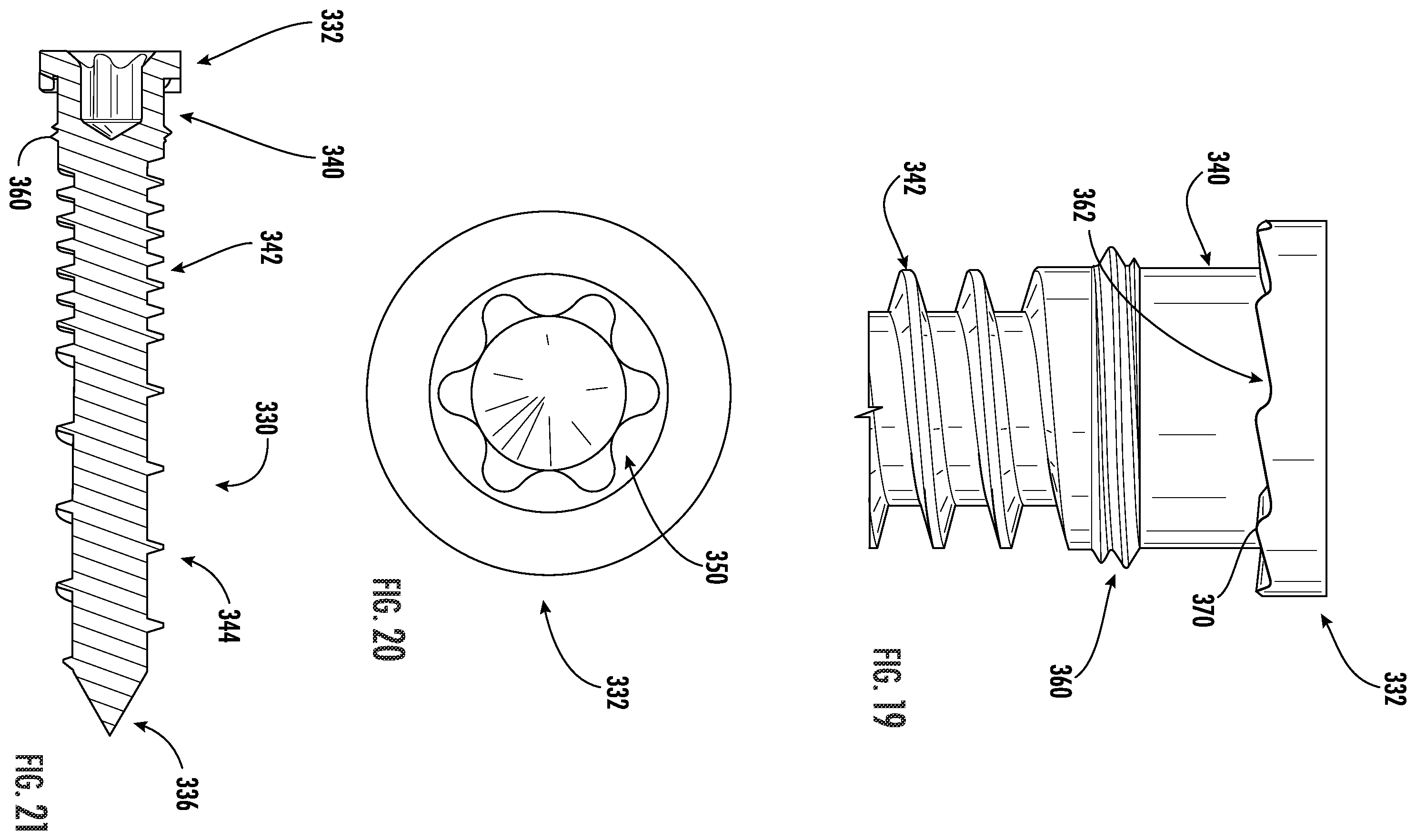 Patent US12551251 Figure 14 – Fixation assemblies for medical implants