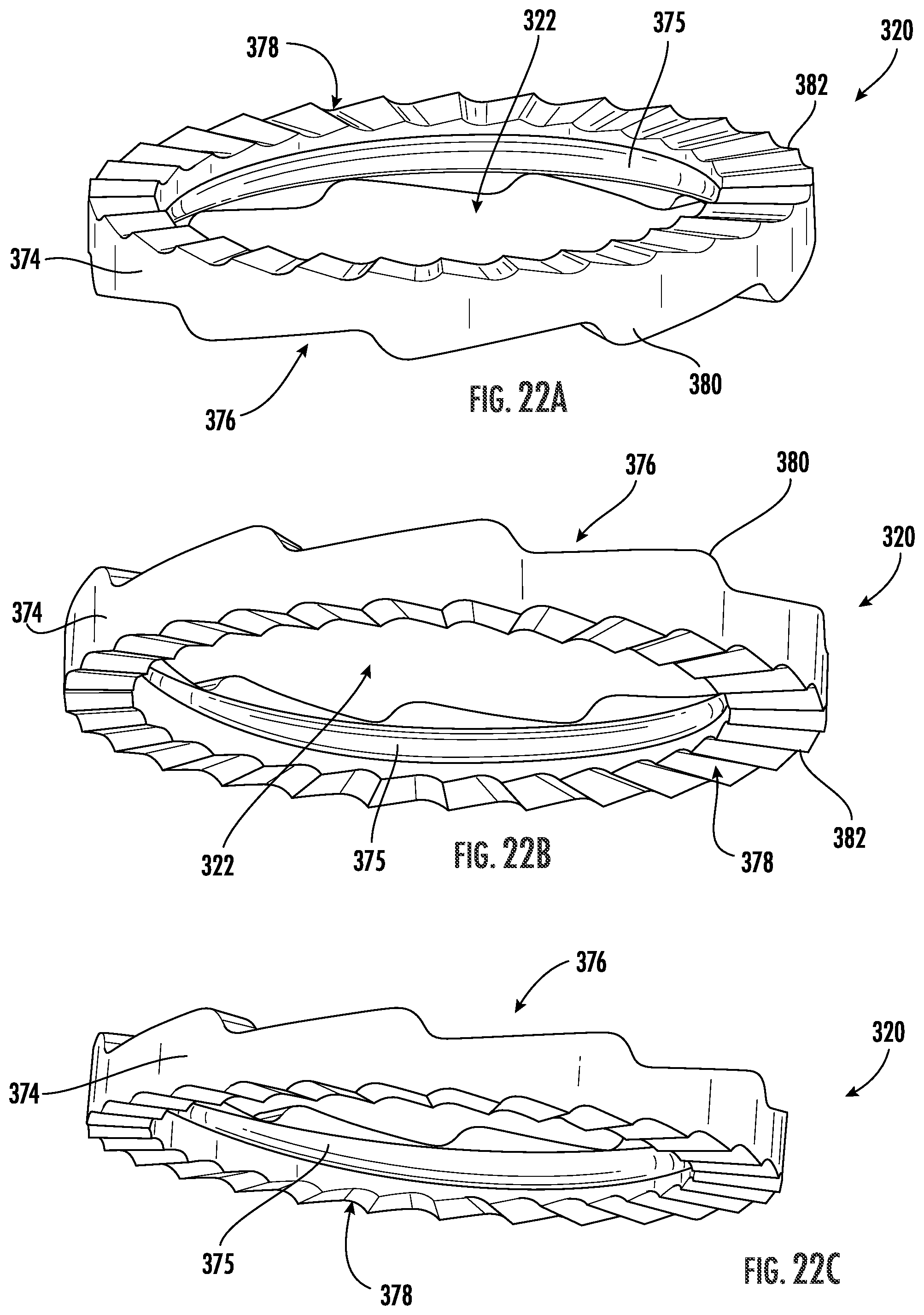 Patent US12551251 Figure 15 – Fixation assemblies for medical implants