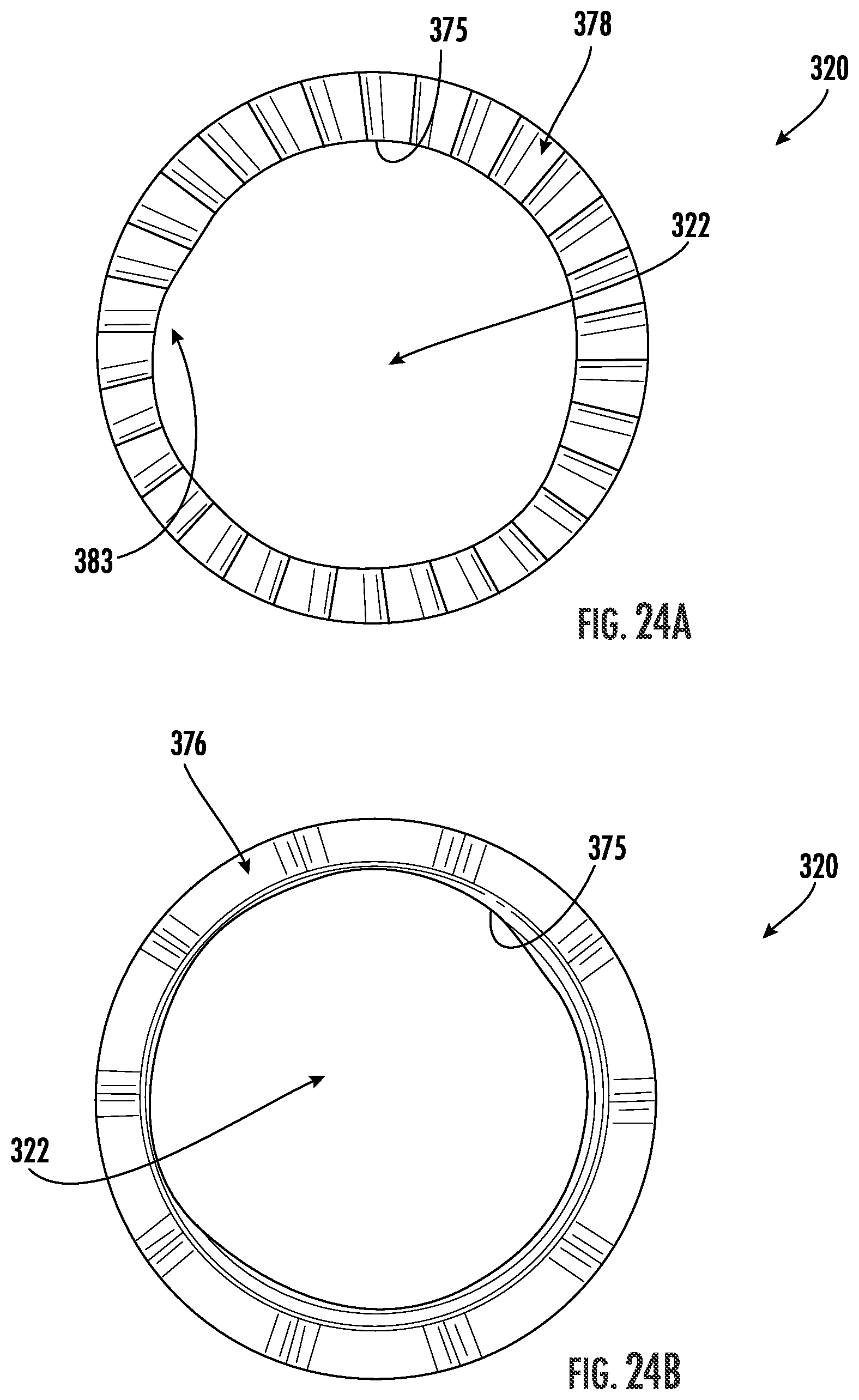Patent US12551251 Figure 18 – Fixation assemblies for medical implants