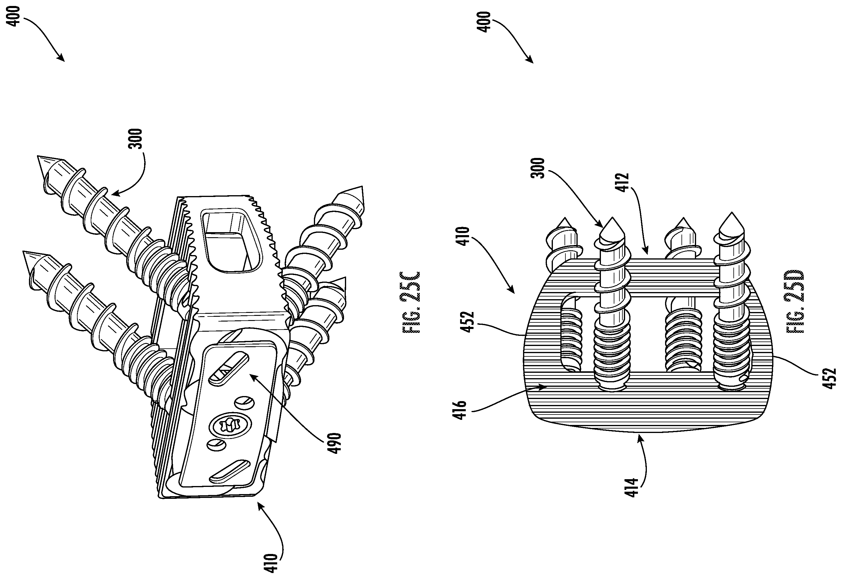 Patent US12551251 Figure 20 – Fixation assemblies for medical implants