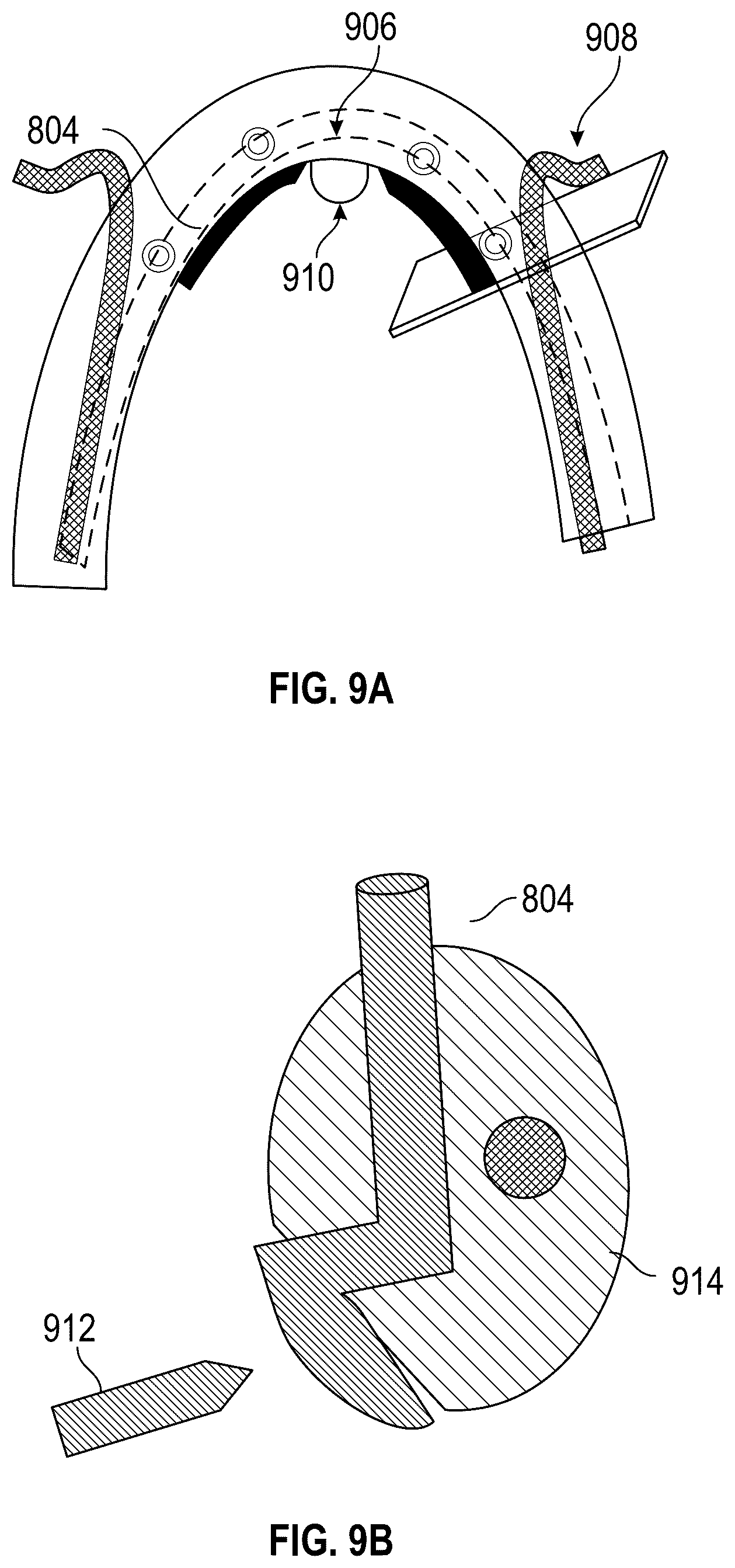 Patent US12551252 Figure 14 – Apparatus and method of an osteotomy for dental implant