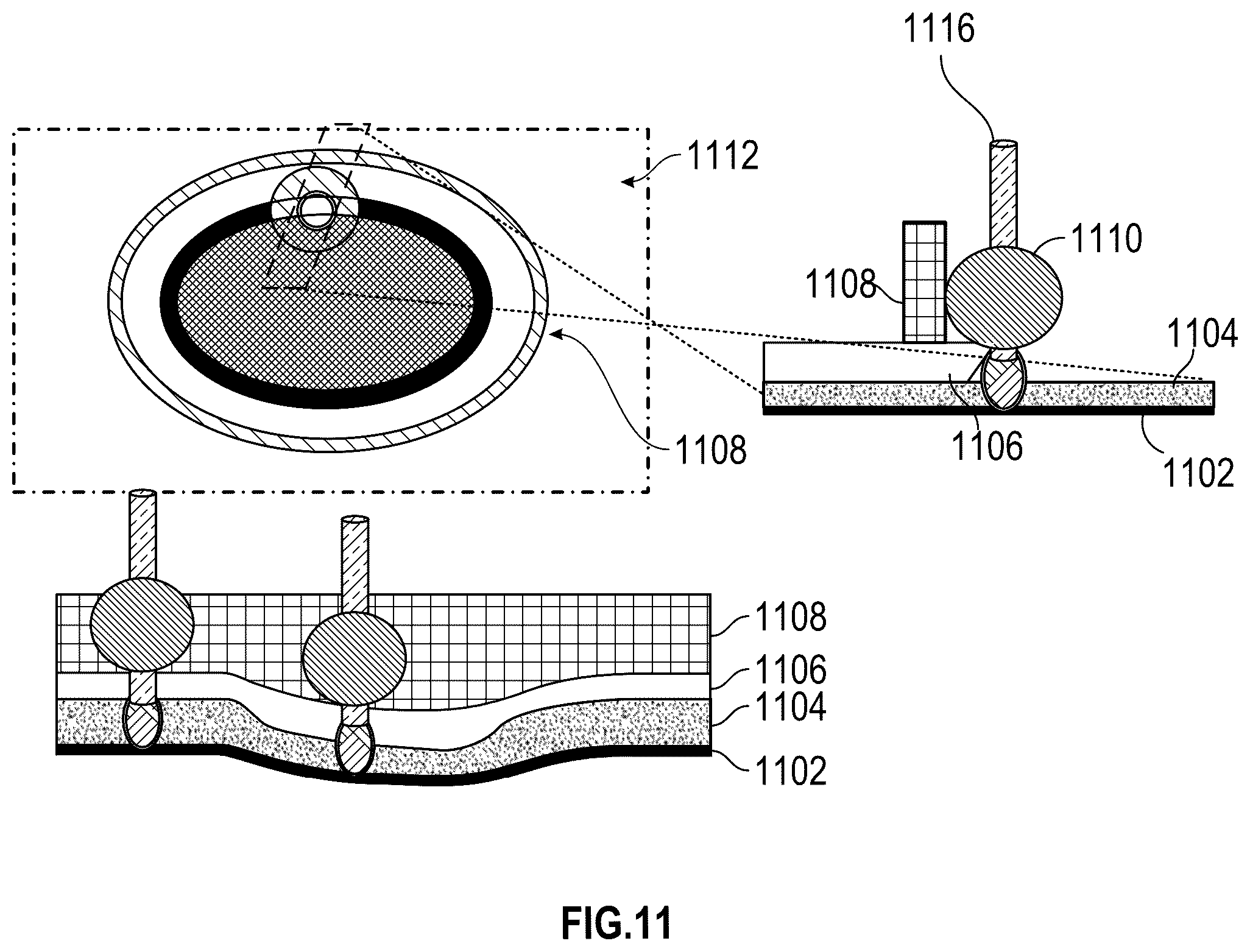 Patent US12551252 Figure 16 – Apparatus and method of an osteotomy for dental implant