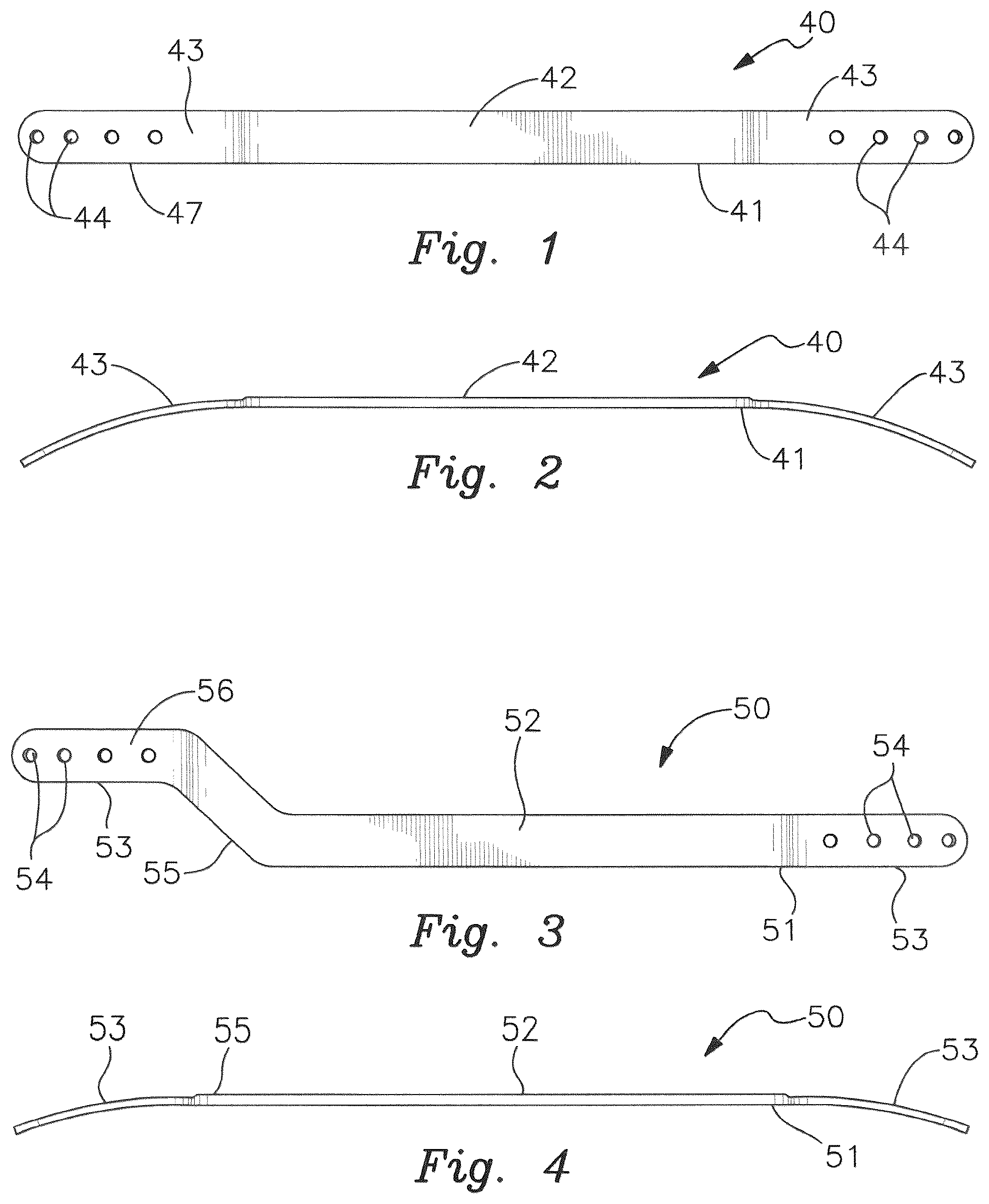 Patent US12551253 Figure 1 – Pectus excavatum treating apparatus