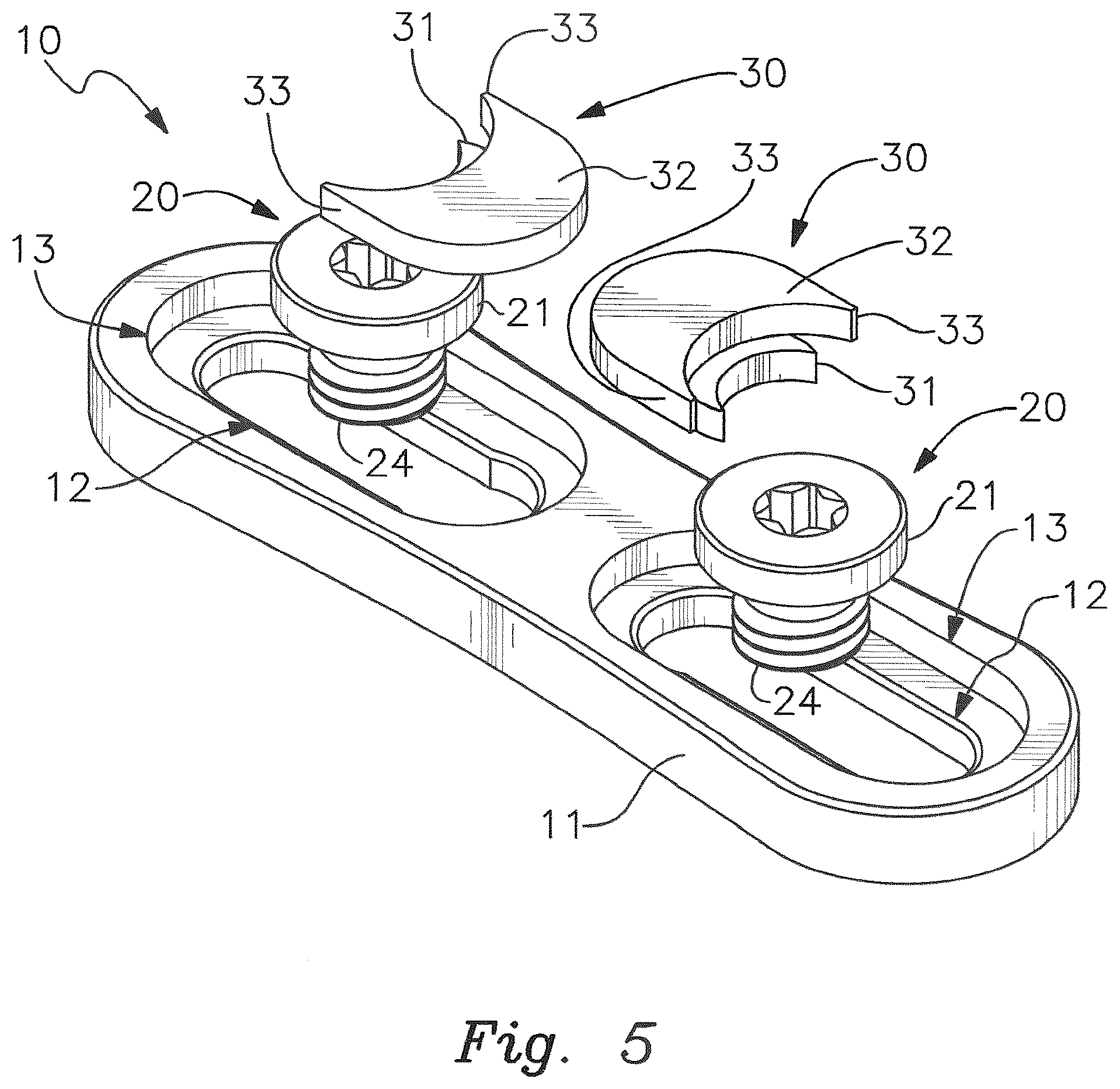 Patent US12551253 Figure 2 – Pectus excavatum treating apparatus
