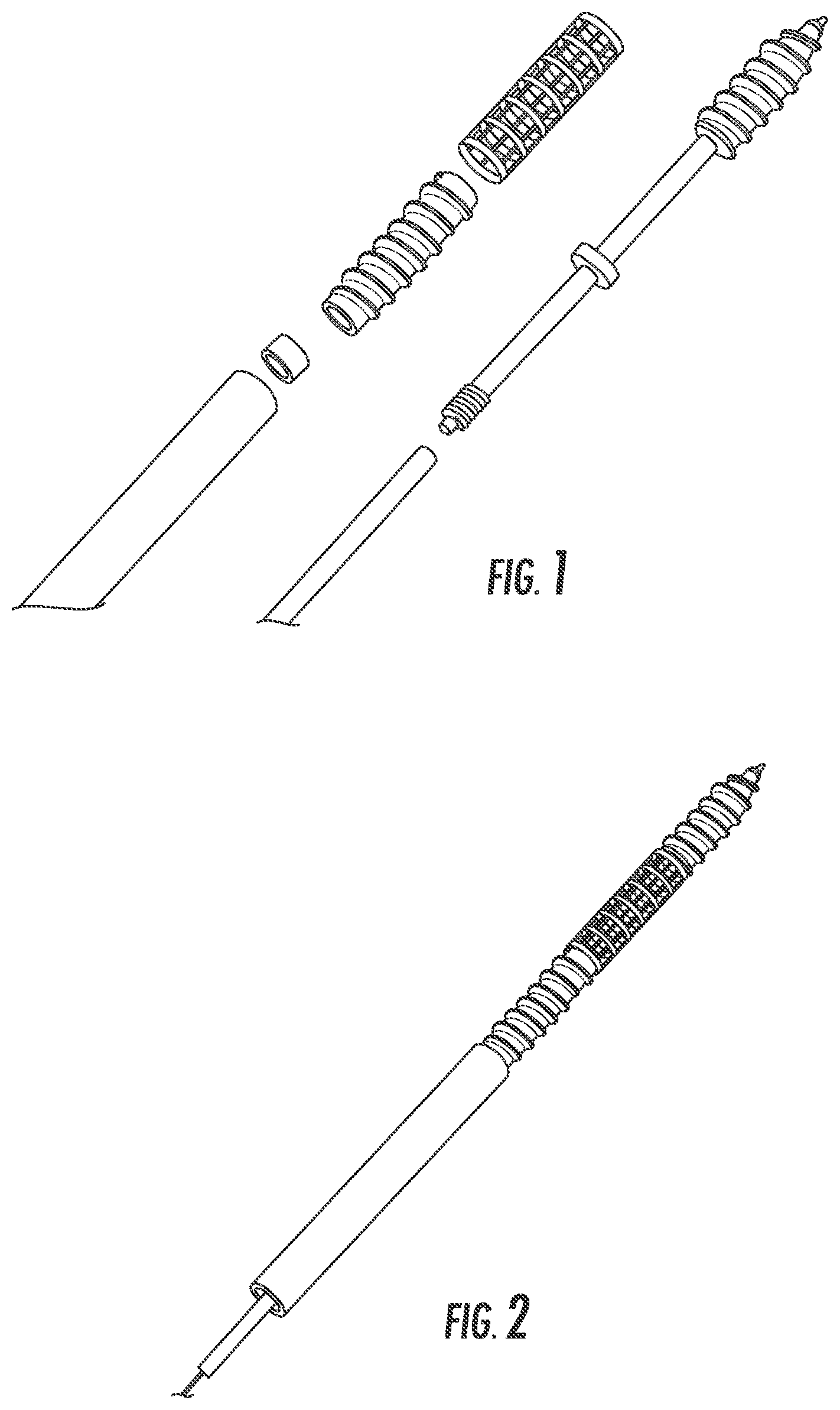 Patent US12551254 Figure 1 – Bone fusion system