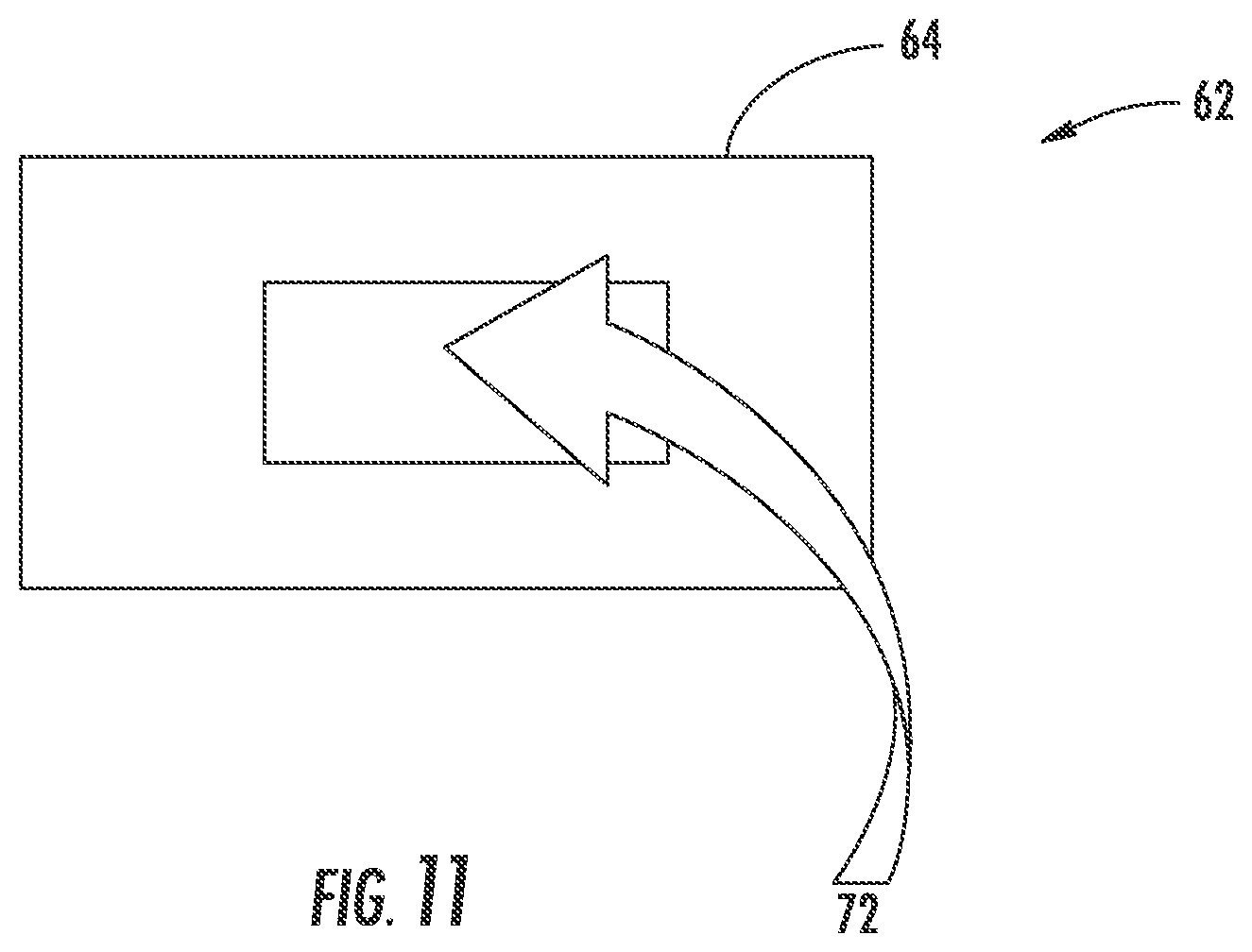 Patent US12551254 Figure 6 – Bone fusion system