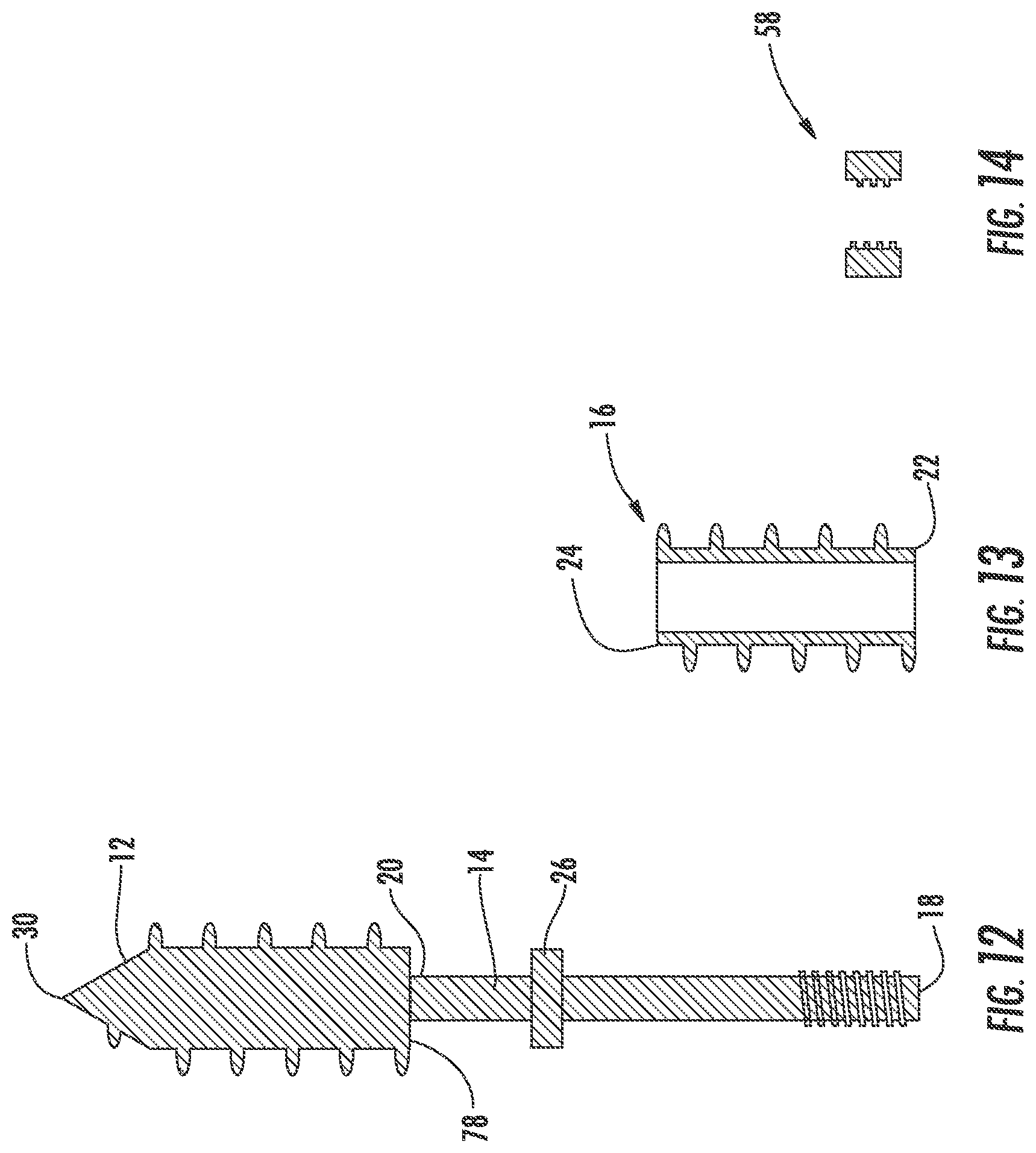 Patent US12551254 Figure 7 – Bone fusion system
