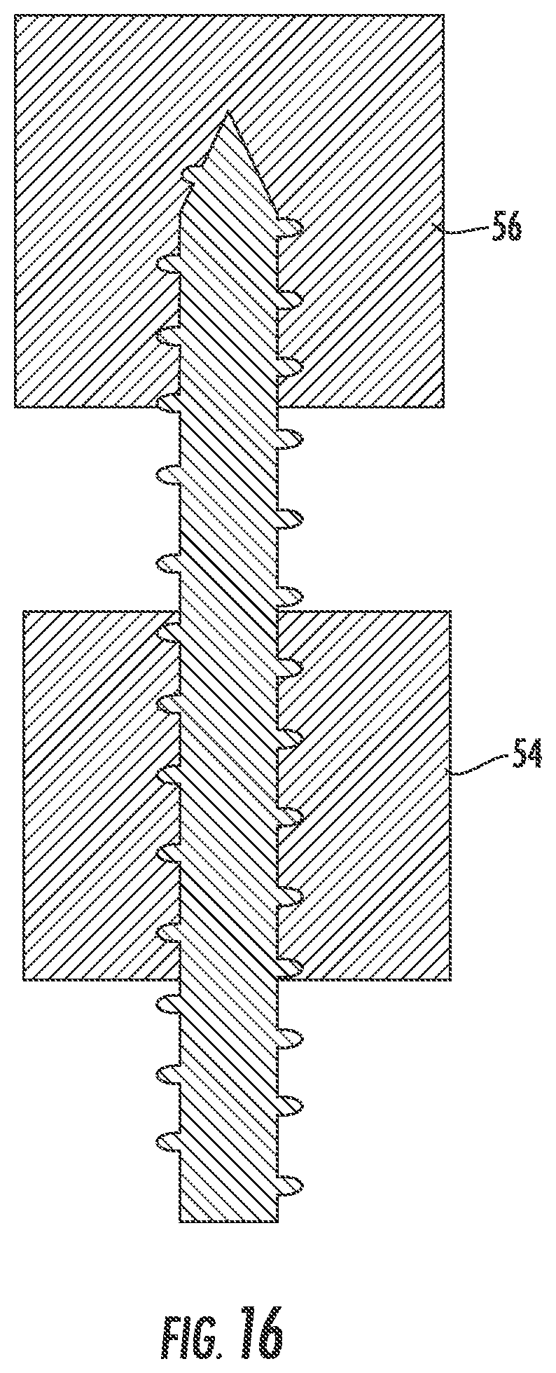 Patent US12551254 Figure 9 – Bone fusion system
