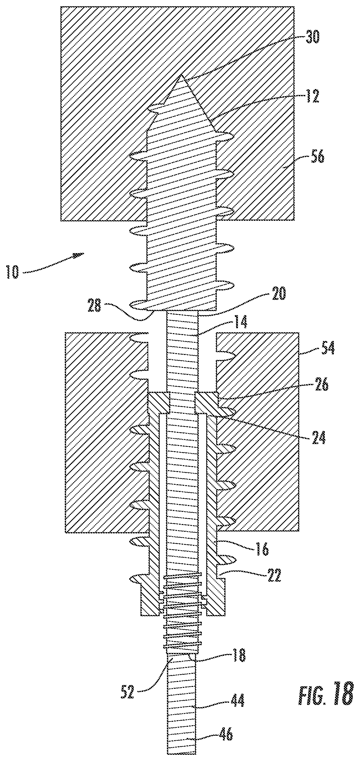 Patent US12551254 Figure 11 – Bone fusion system