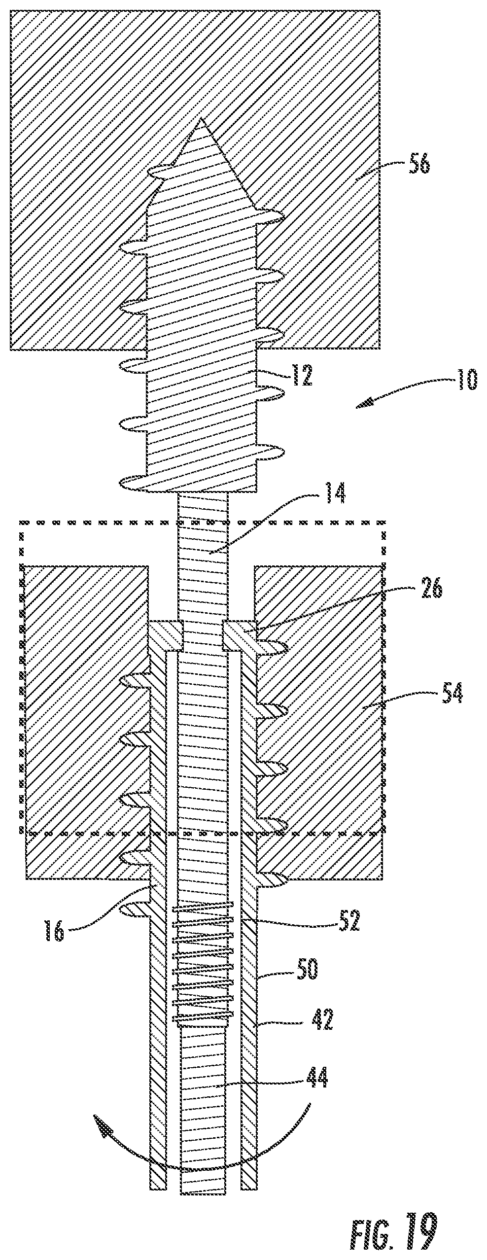 Patent US12551254 Figure 12 – Bone fusion system