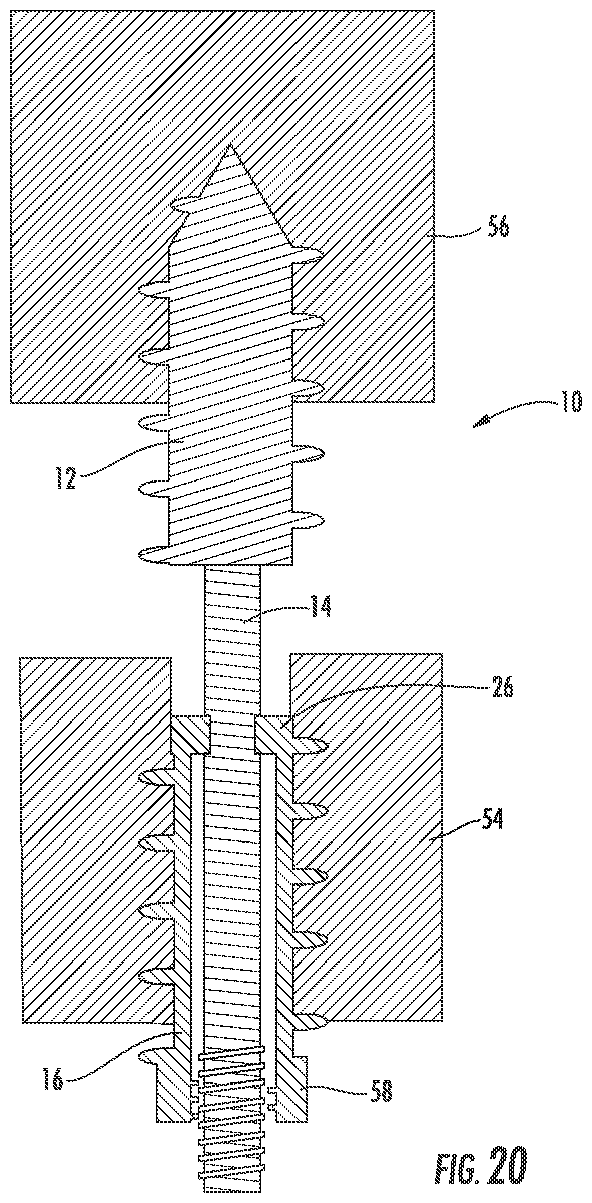 Patent US12551254 Figure 13 – Bone fusion system