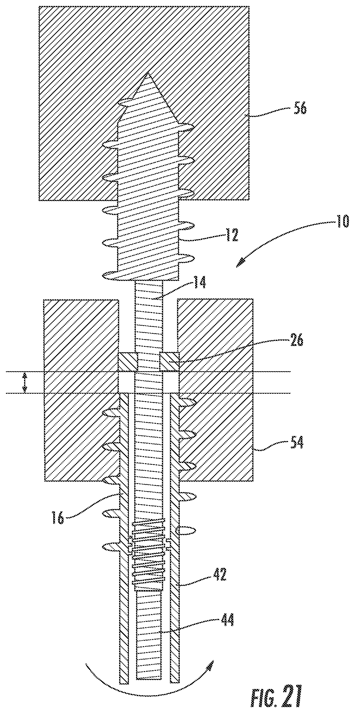 Patent US12551254 Figure 14 – Bone fusion system