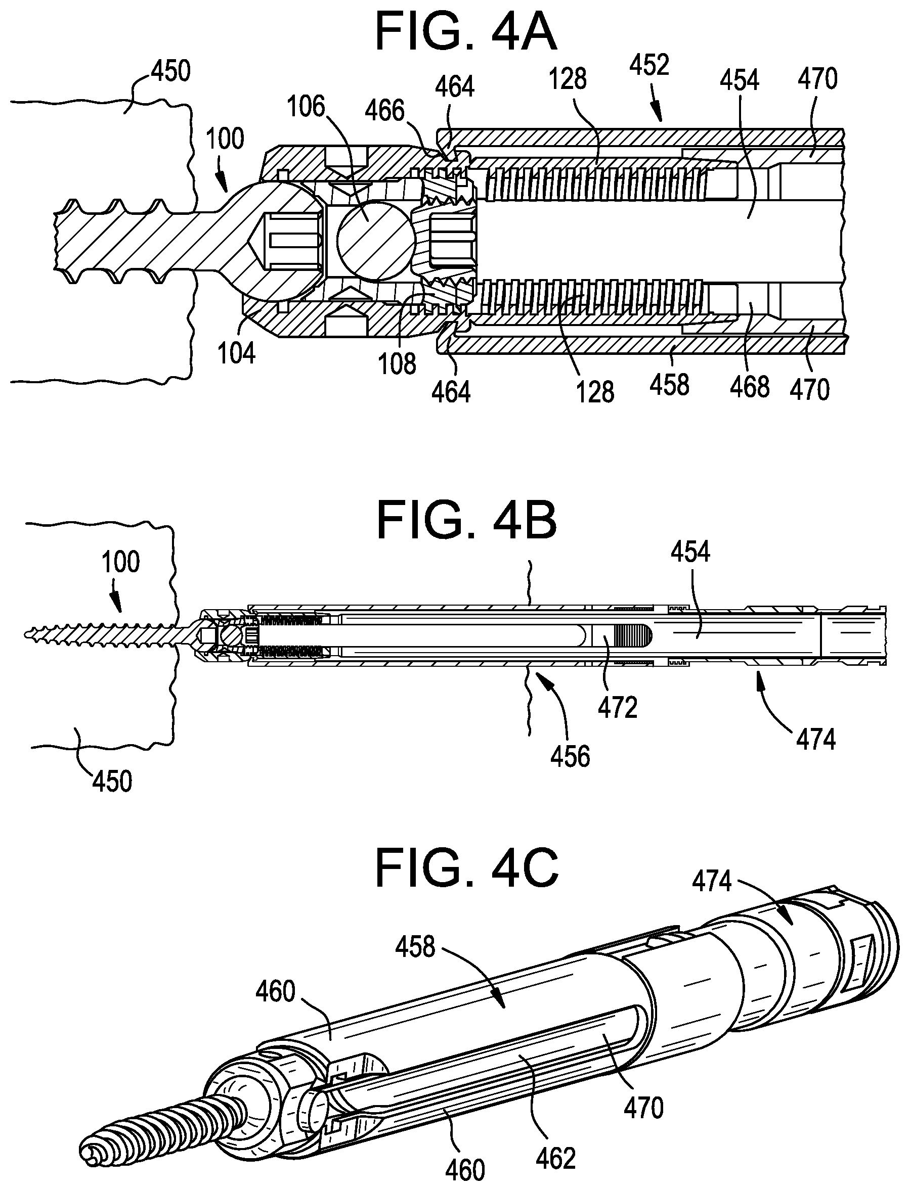 Patent US12551256 Figure 6 – Instruments and related methods for breaking reduction tabs