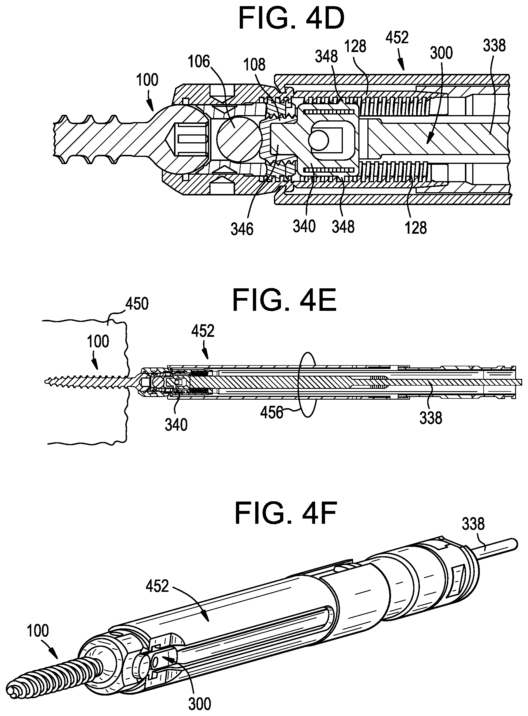 Patent US12551256 Figure 7 – Instruments and related methods for breaking reduction tabs