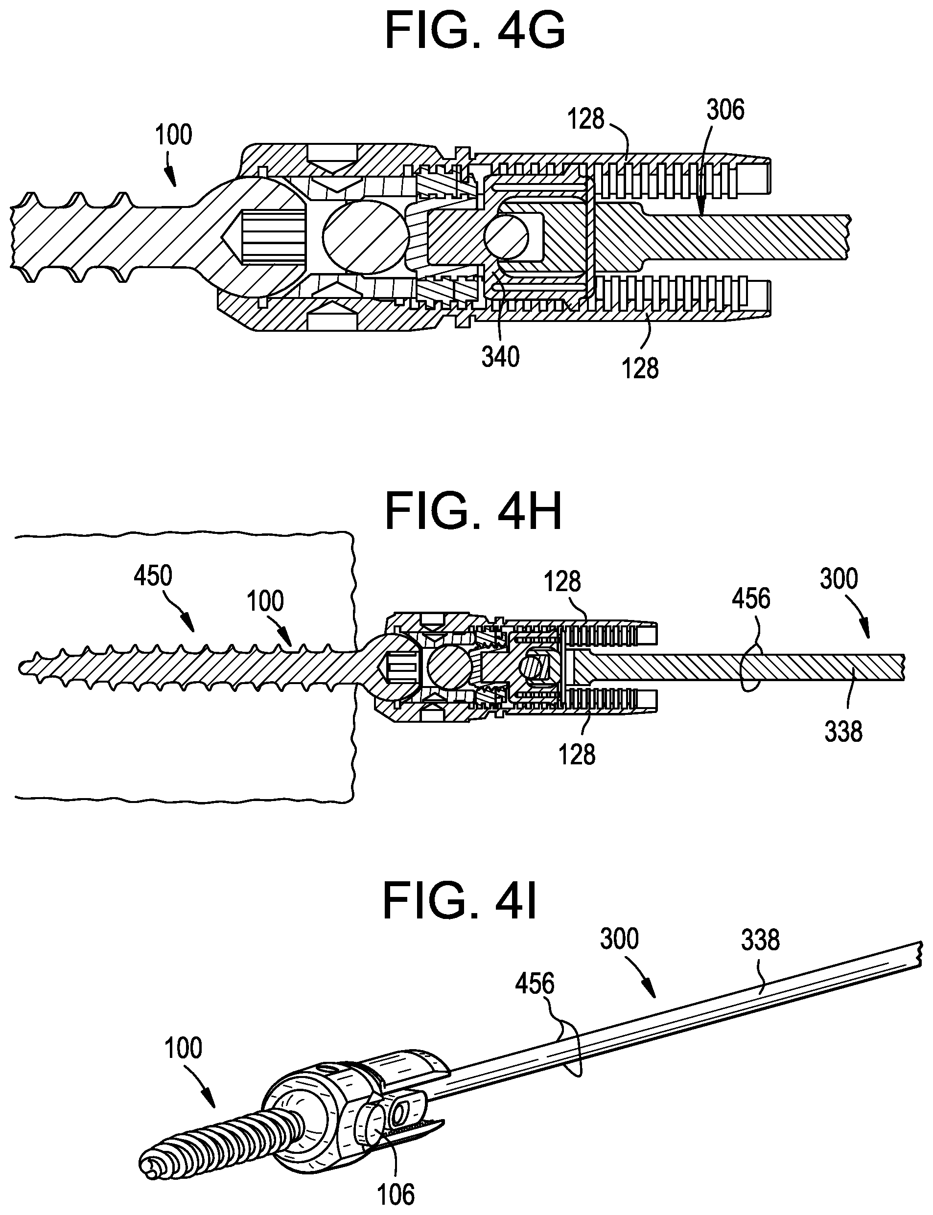 Patent US12551256 Figure 8 – Instruments and related methods for breaking reduction tabs