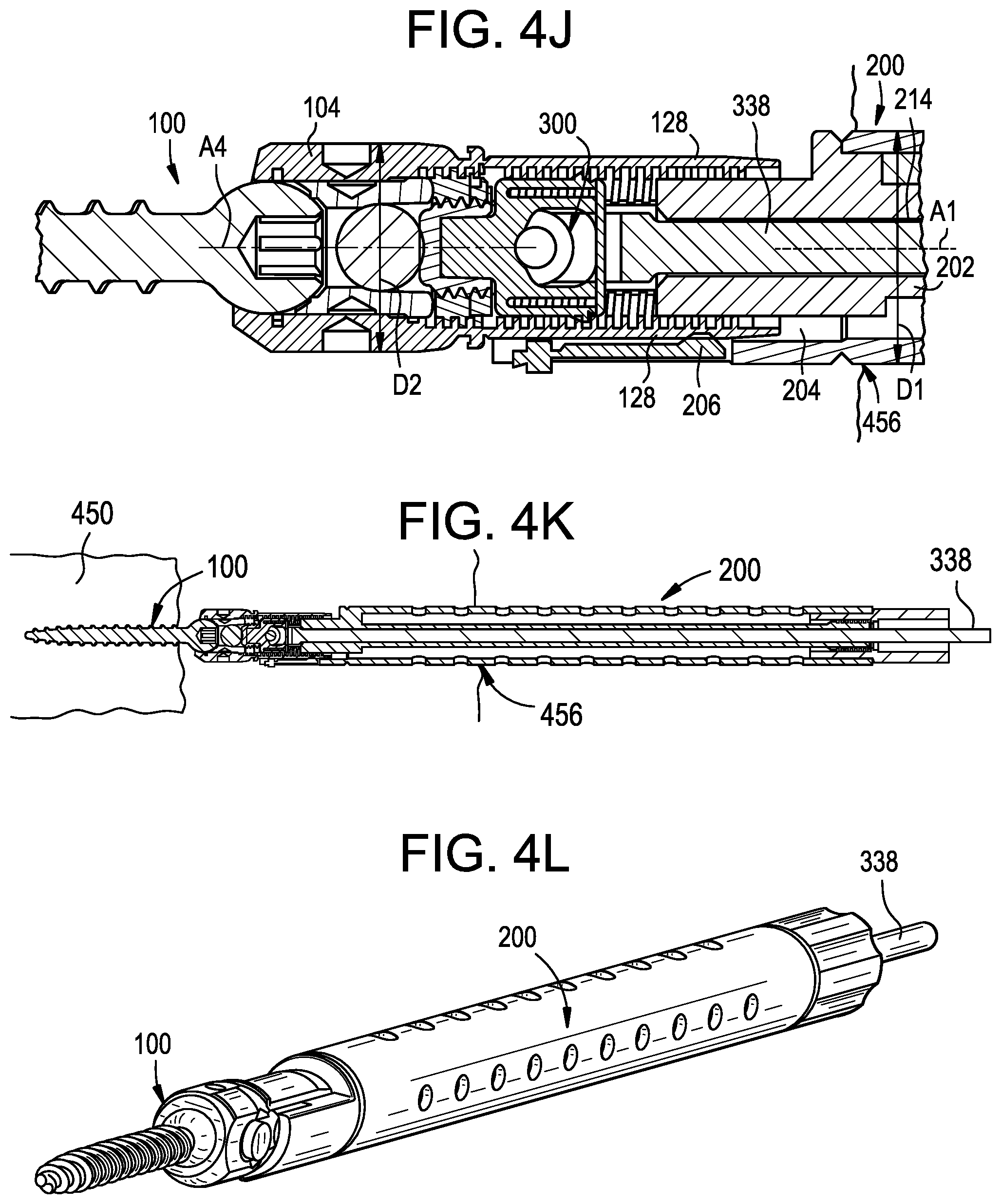 Patent US12551256 Figure 9 – Instruments and related methods for breaking reduction tabs