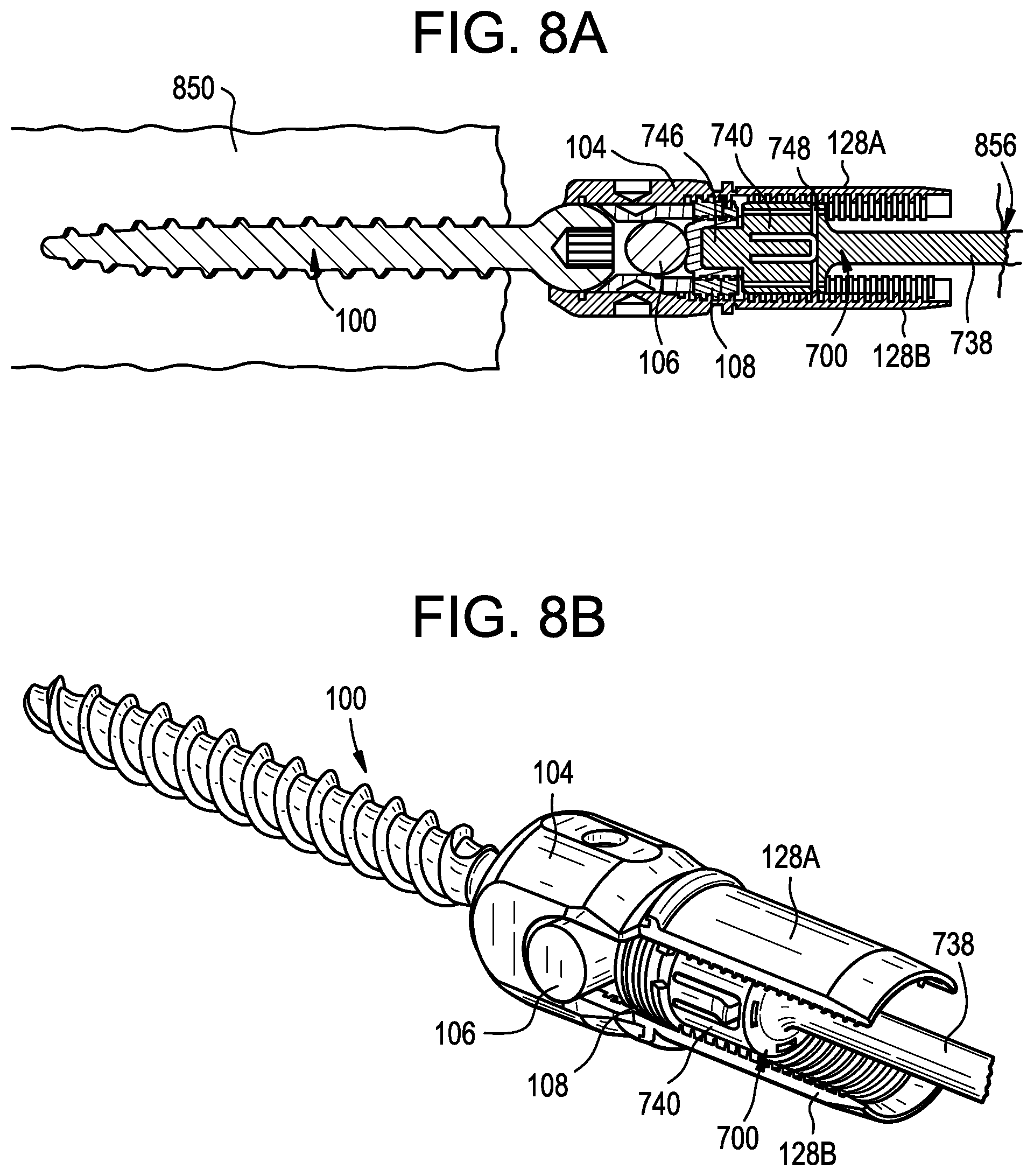 Patent US12551256 Figure 17 – Instruments and related methods for breaking reduction tabs