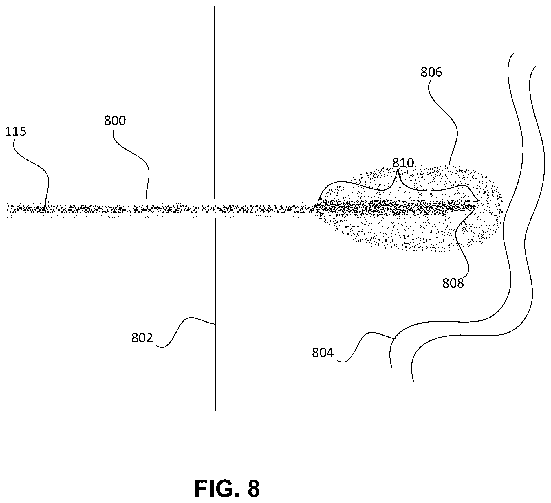 Patent US12551258 Figure 9 – Medial branch smart tip needle