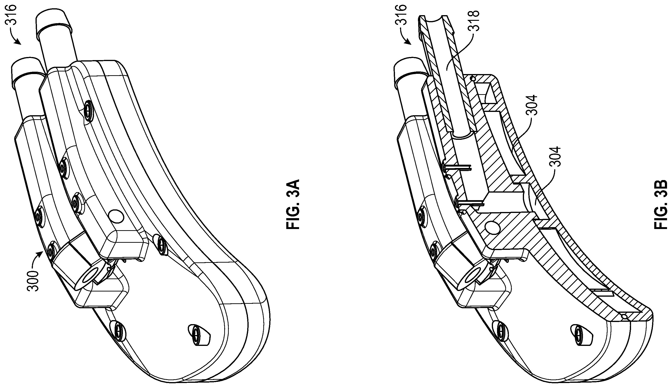 Patent US12551259 Figure 3 – Systems and methods for treatment of obstructive sleep apnea