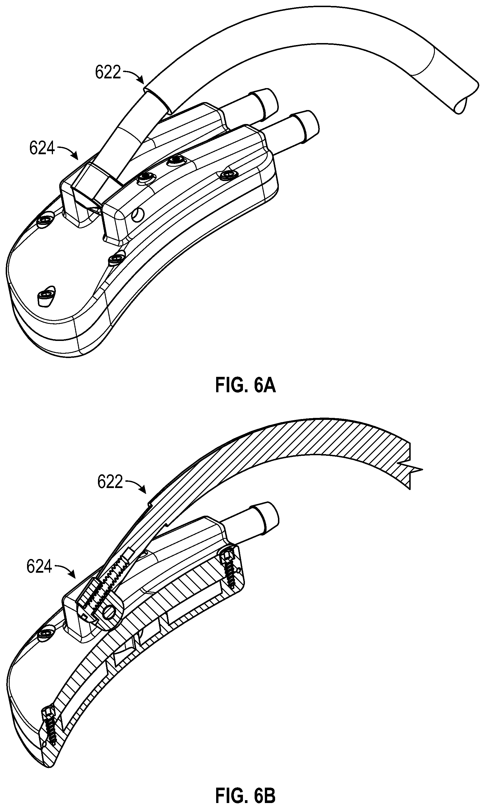 Patent US12551259 Figure 6 – Systems and methods for treatment of obstructive sleep apnea