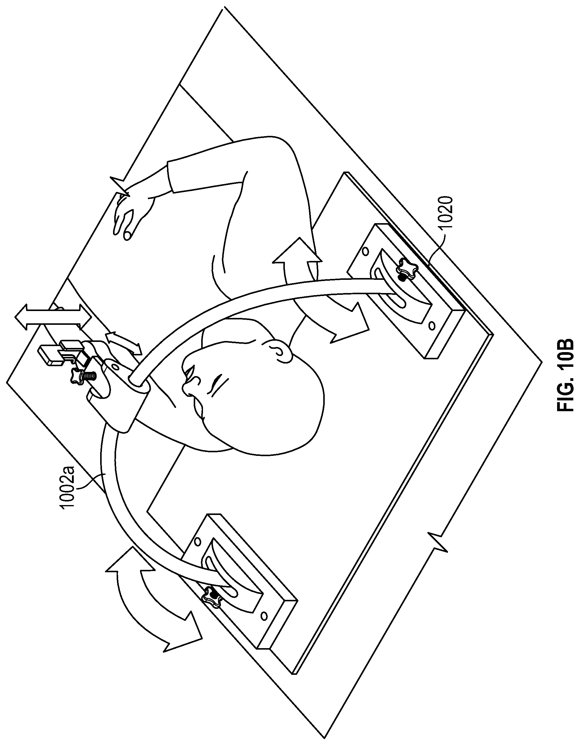 Patent US12551259 Figure 12 – Systems and methods for treatment of obstructive sleep apnea