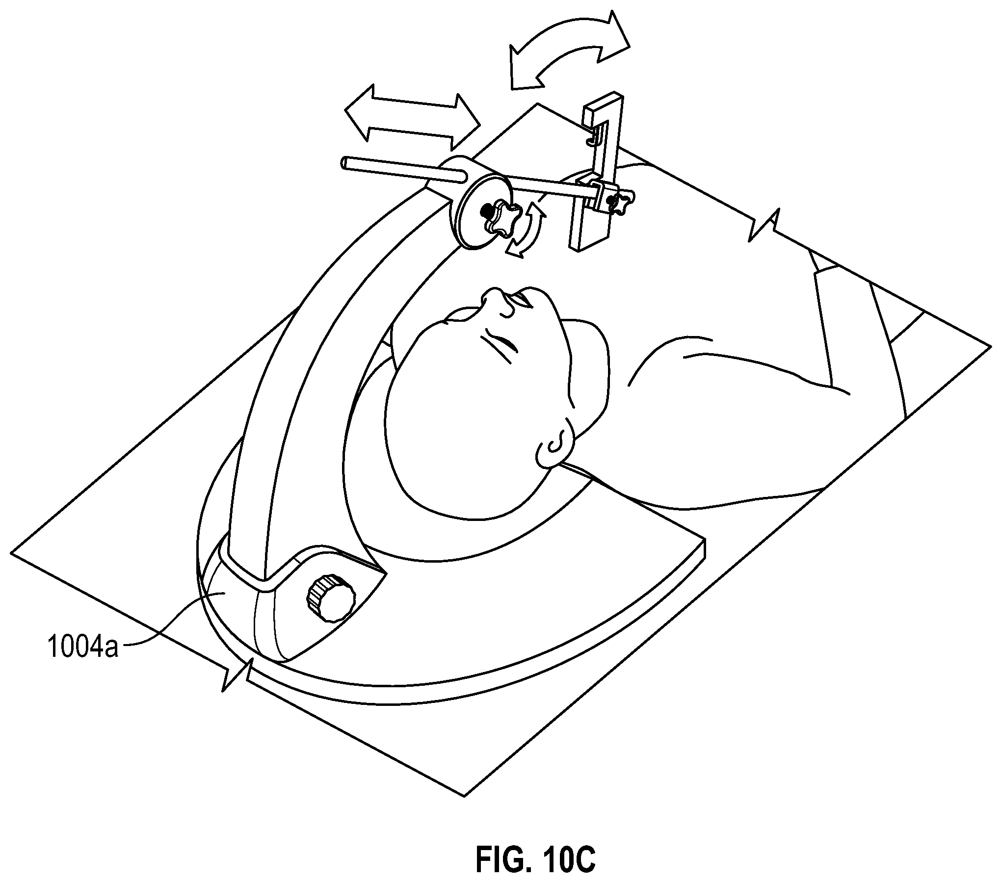 Patent US12551259 Figure 13 – Systems and methods for treatment of obstructive sleep apnea