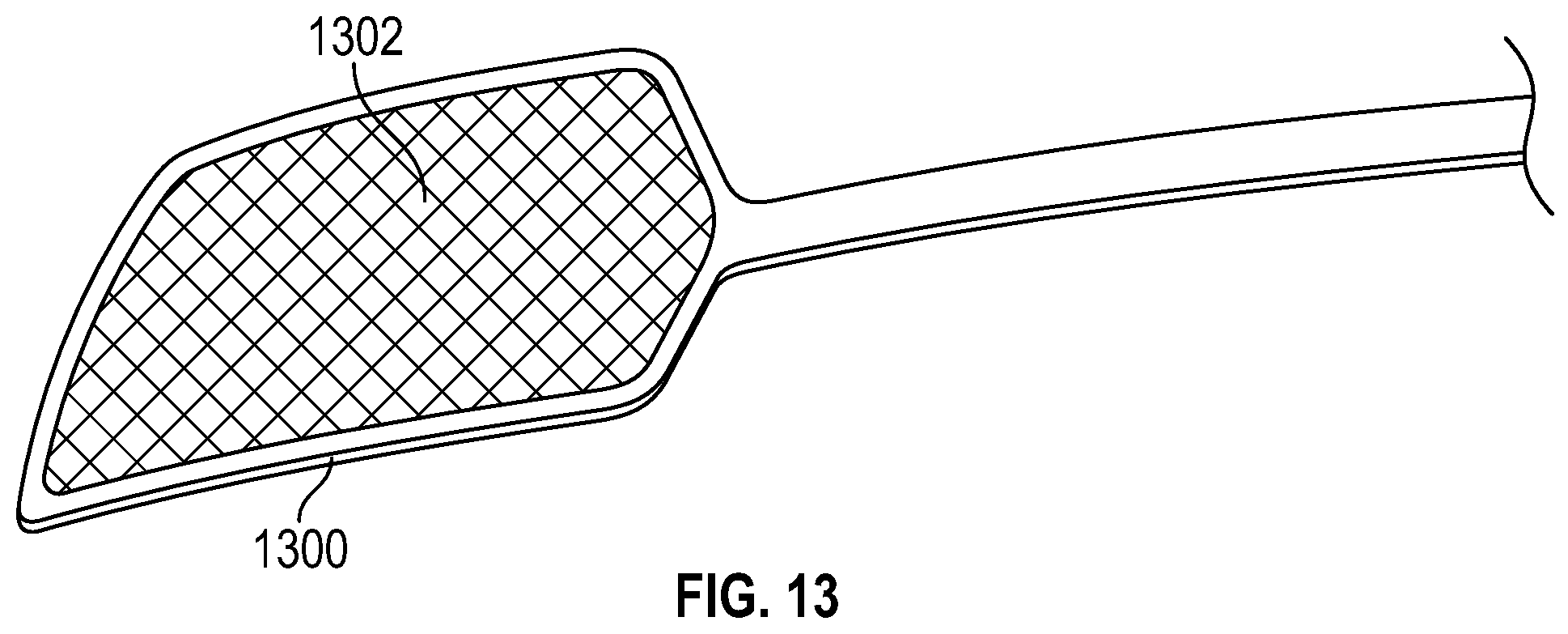 Patent US12551259 Figure 17 – Systems and methods for treatment of obstructive sleep apnea
