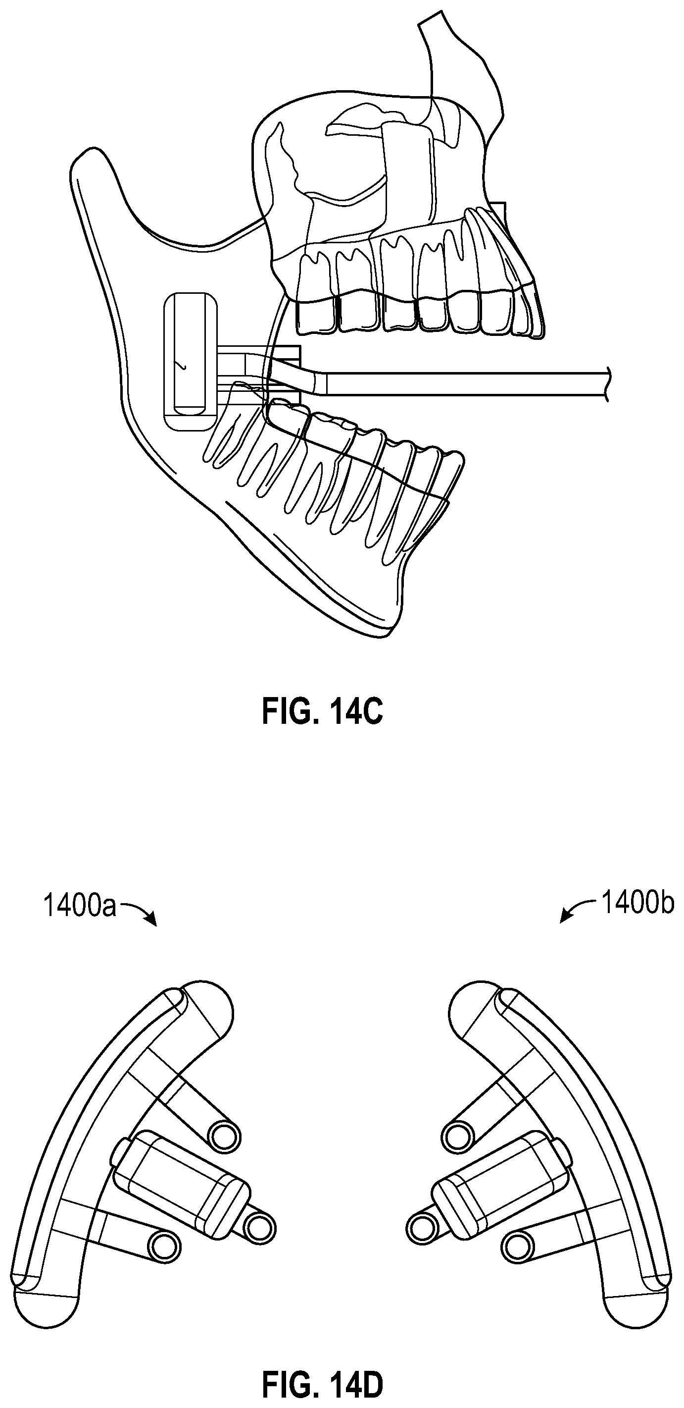 Patent US12551259 Figure 19 – Systems and methods for treatment of obstructive sleep apnea