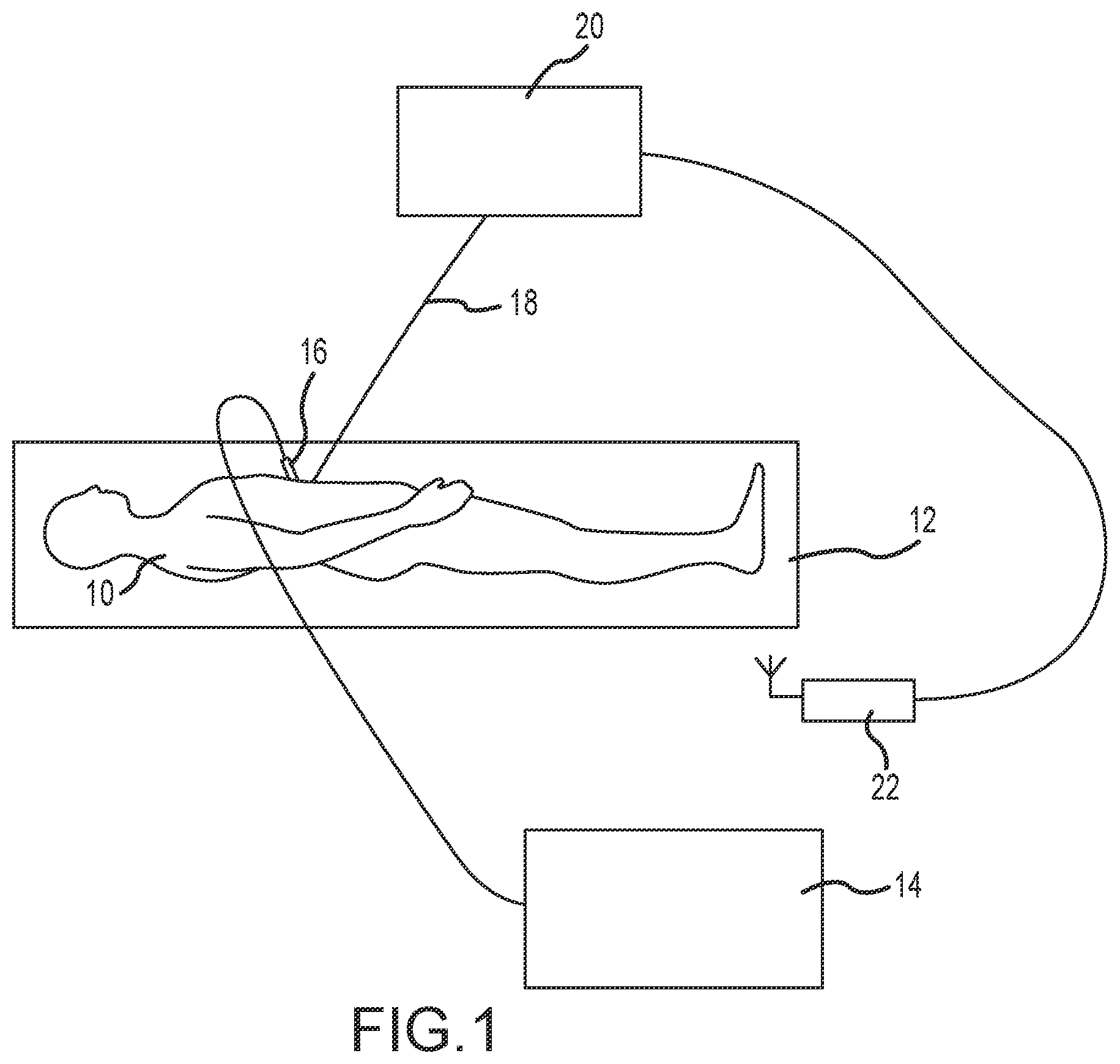 Patent US12551263 — System and apparatus for automatic activation using radio frequency sensor — Figure 1