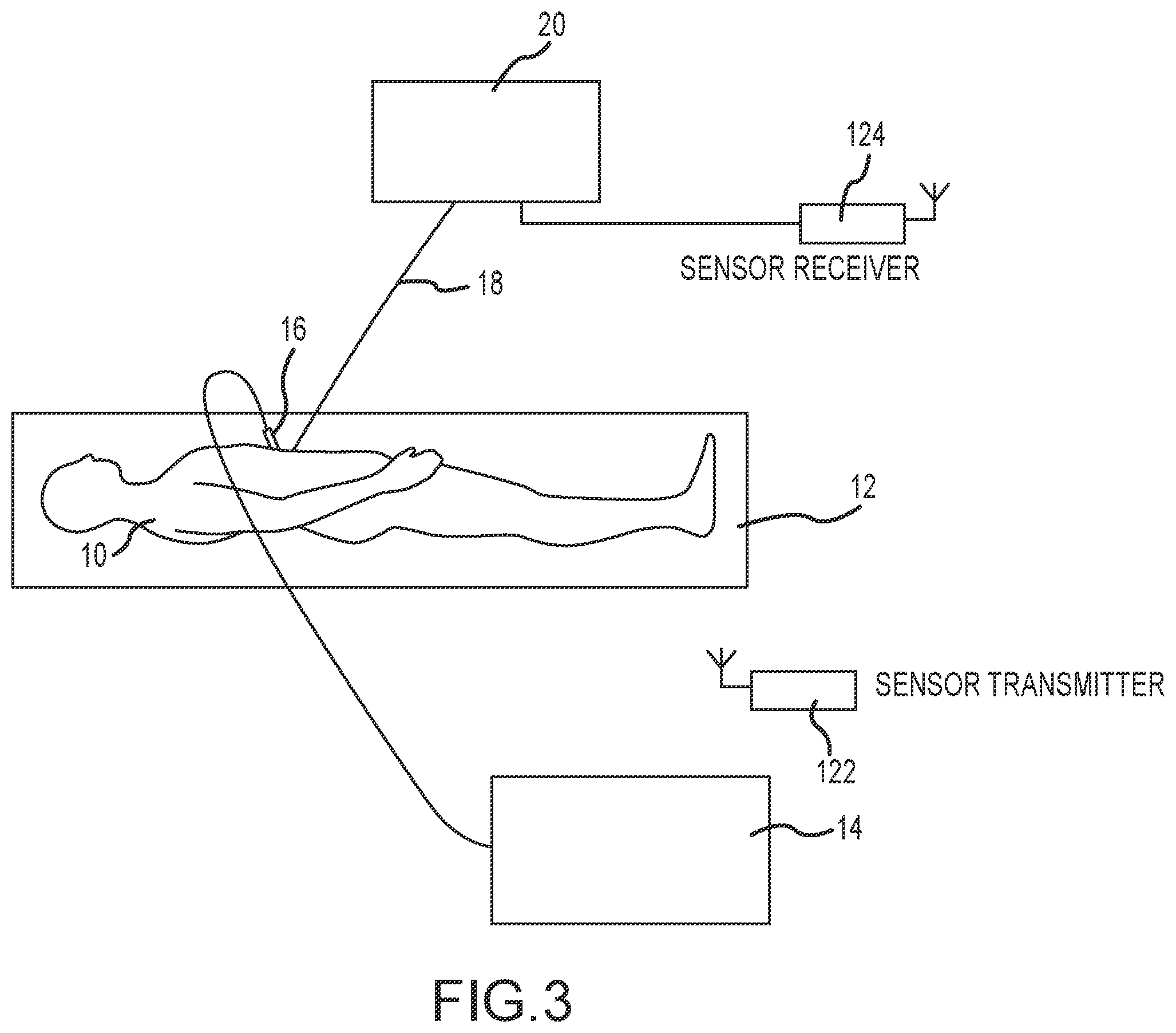 Patent US12551263 Figure 3 – System and apparatus for automatic activation using radio frequency sensor