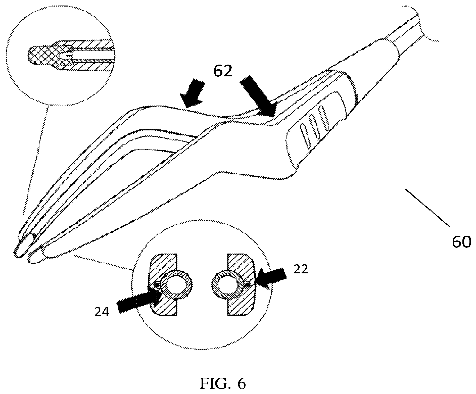 Patent US12551264 Figure 6 – Biocompatible metal devices for delivering ablative energy