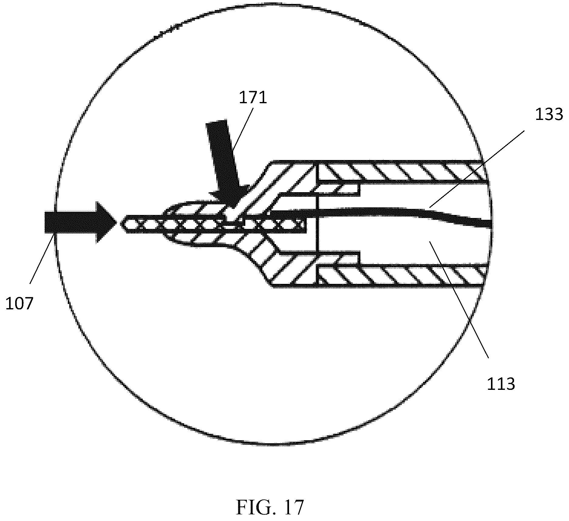 Patent US12551264 Figure 17 – Biocompatible metal devices for delivering ablative energy