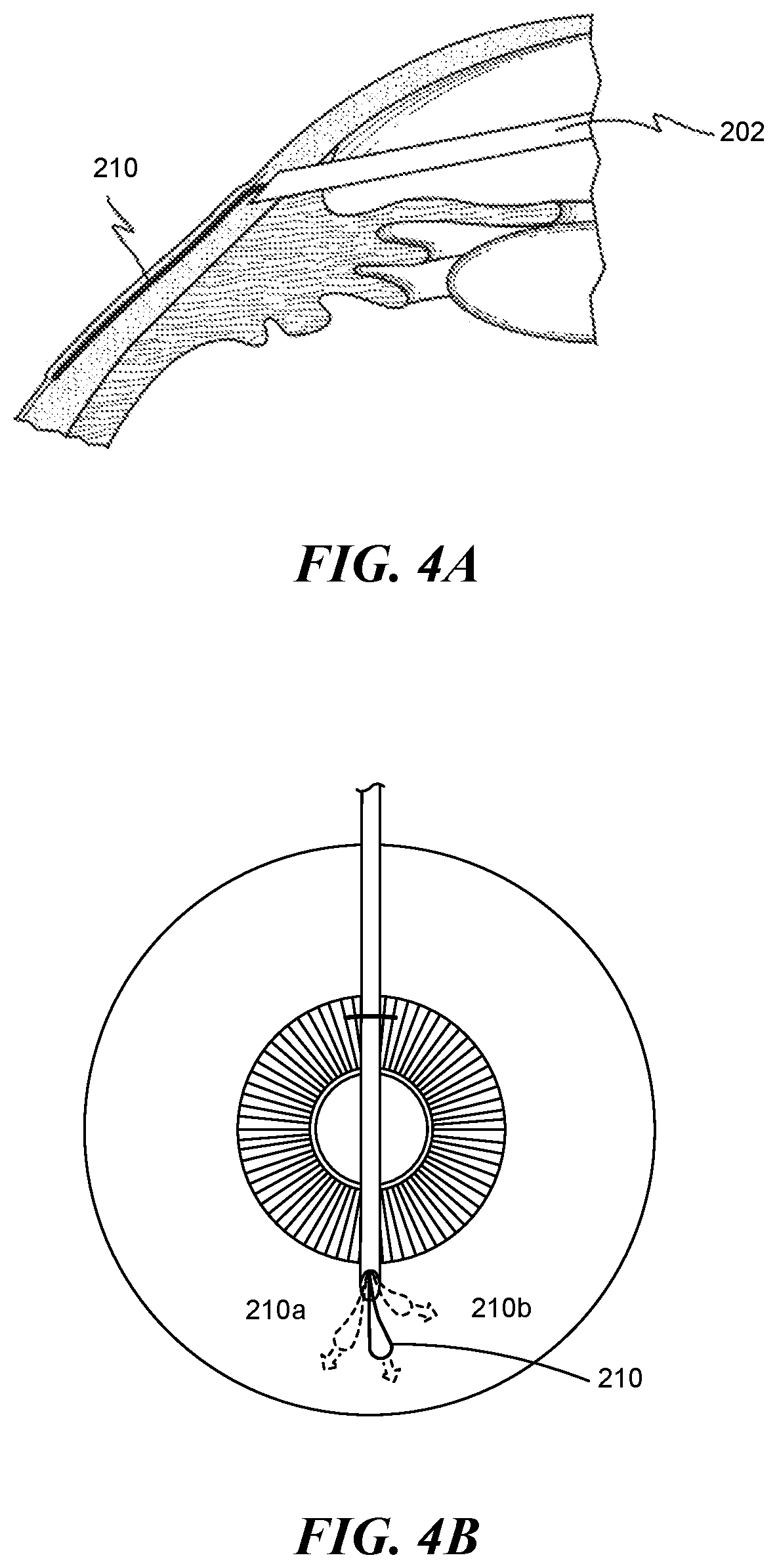 Patent US12551268 Figure 3 – Minimally invasive bleb formation devices and methods for using such devices