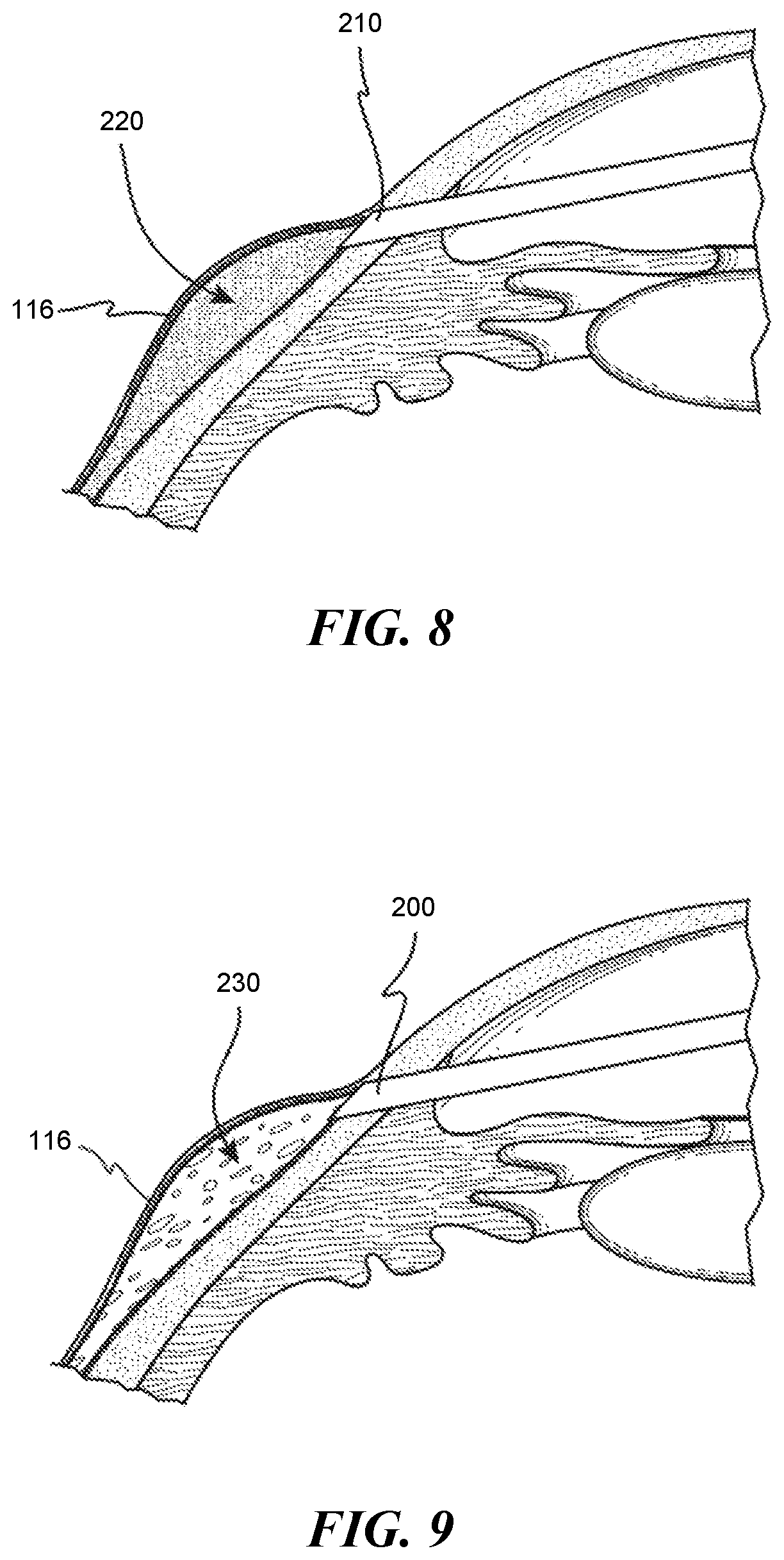 Patent US12551268 Figure 6 – Minimally invasive bleb formation devices and methods for using such devices