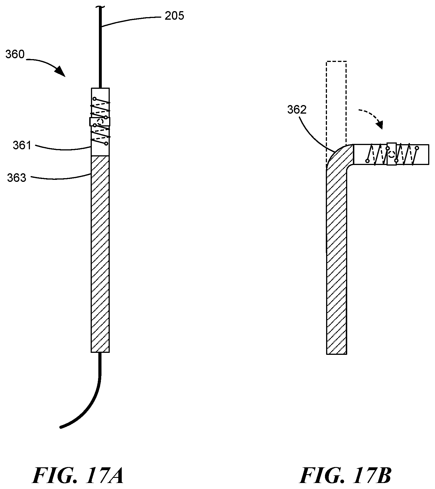 Patent US12551268 Figure 13 – Minimally invasive bleb formation devices and methods for using such devices