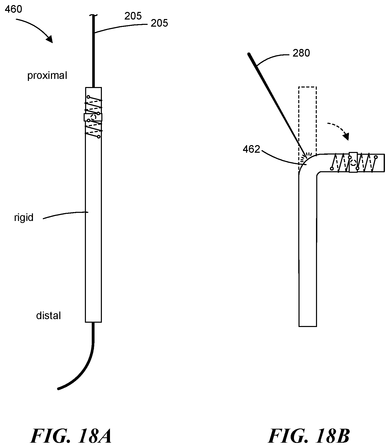 Patent US12551268 Figure 14 – Minimally invasive bleb formation devices and methods for using such devices