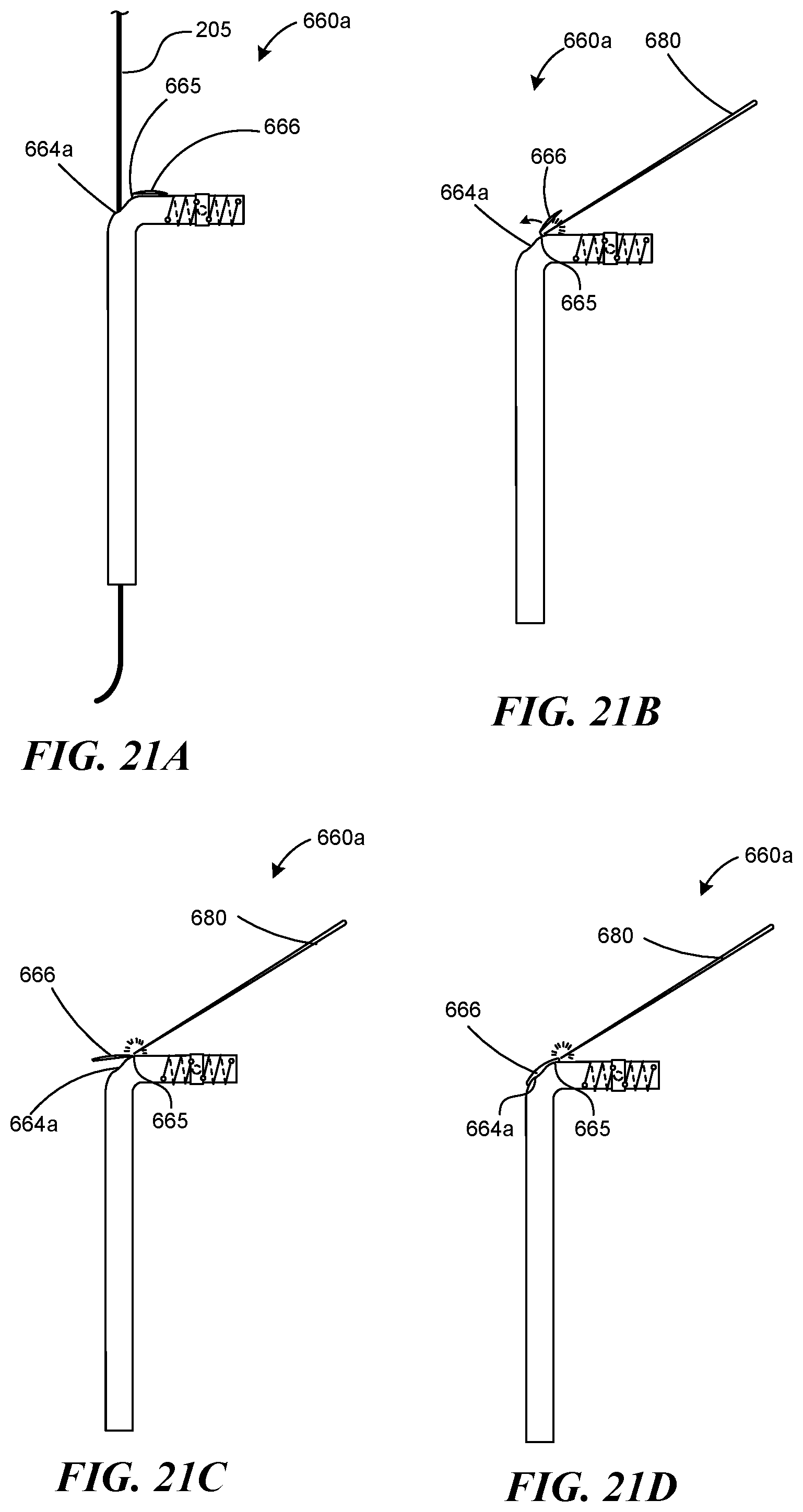 Patent US12551268 Figure 17 – Minimally invasive bleb formation devices and methods for using such devices