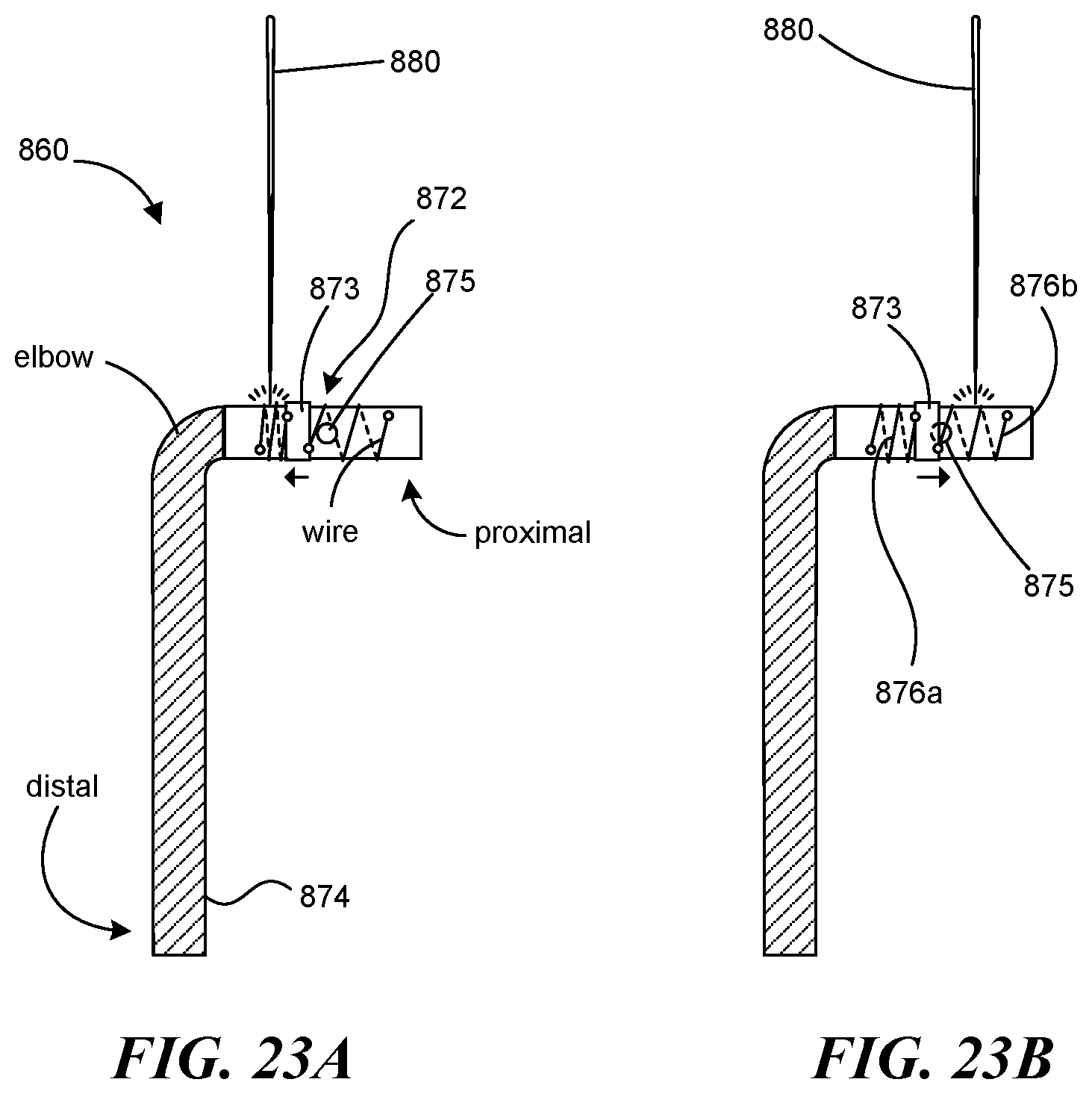 Patent US12551268 Figure 19 – Minimally invasive bleb formation devices and methods for using such devices