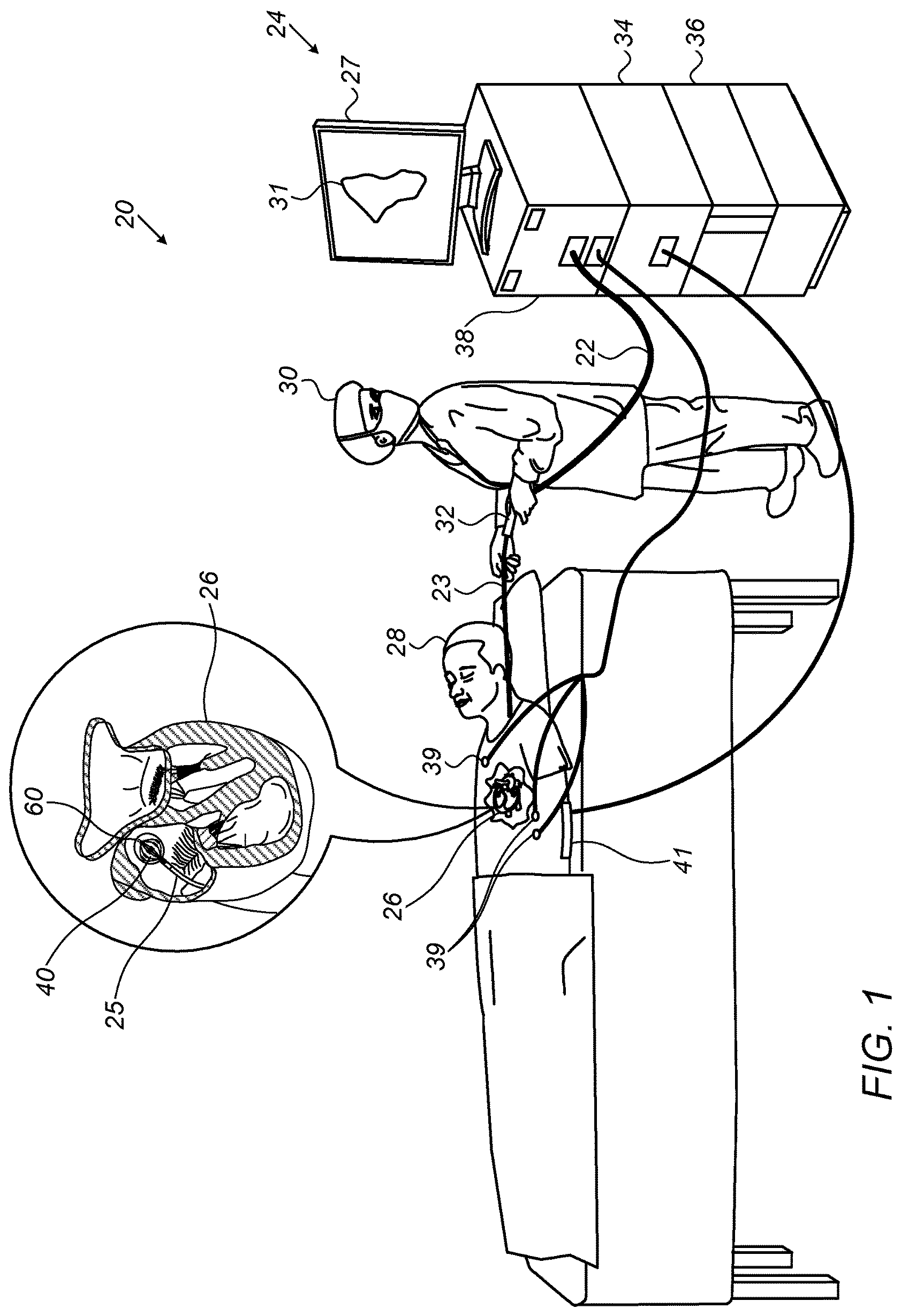 Patent US12551271 Figure 1 – Basket catheter with cushioning porous sheath cover
