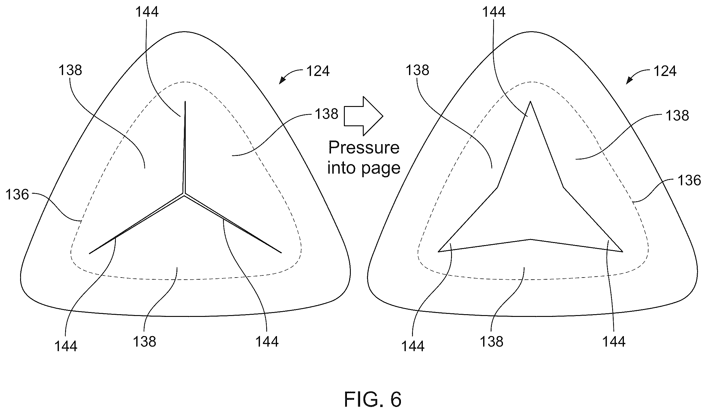 Patent US12551273 Figure 6 – Ablation catheters and related systems and methods