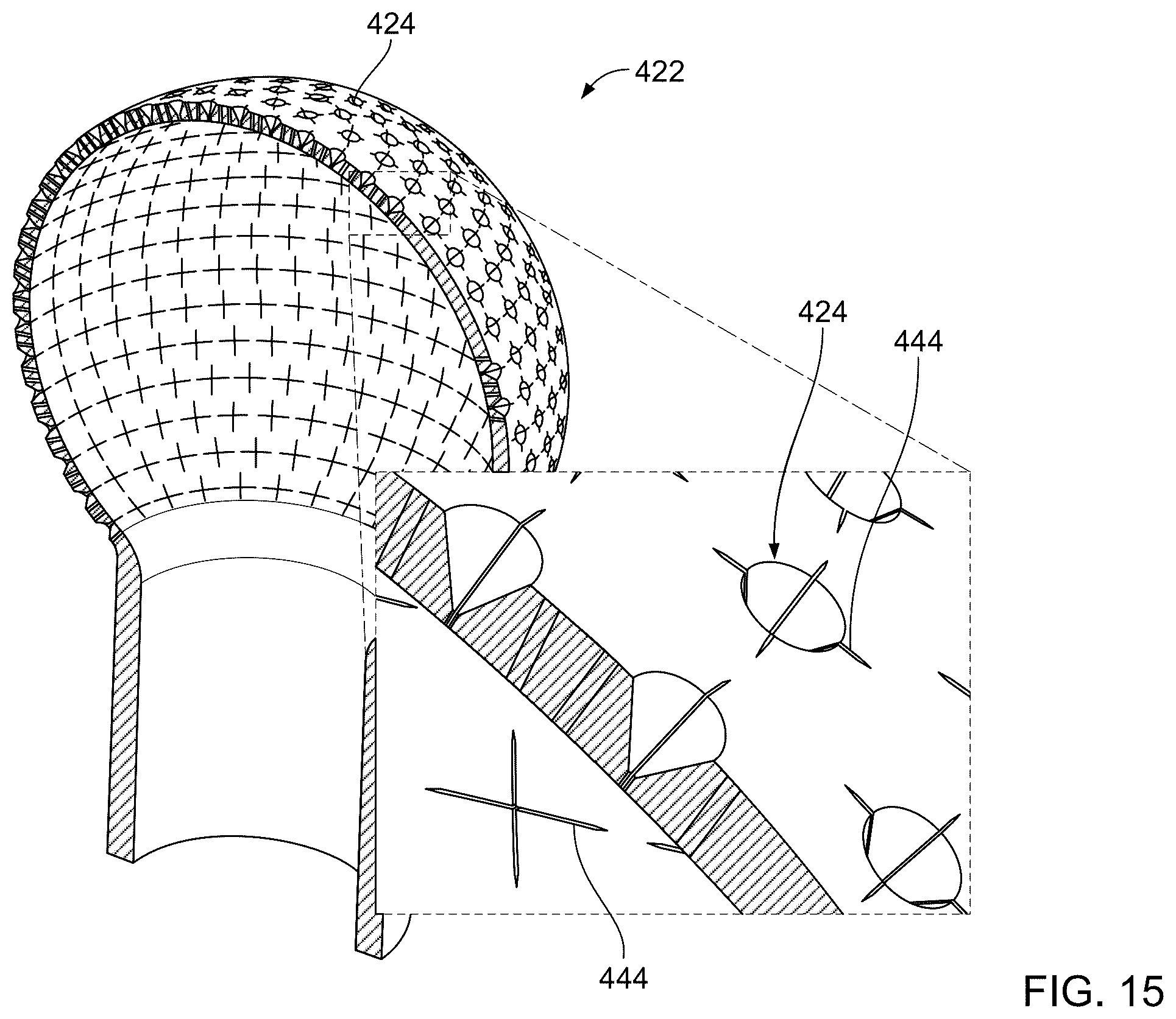 Patent US12551273 Figure 13 – Ablation catheters and related systems and methods