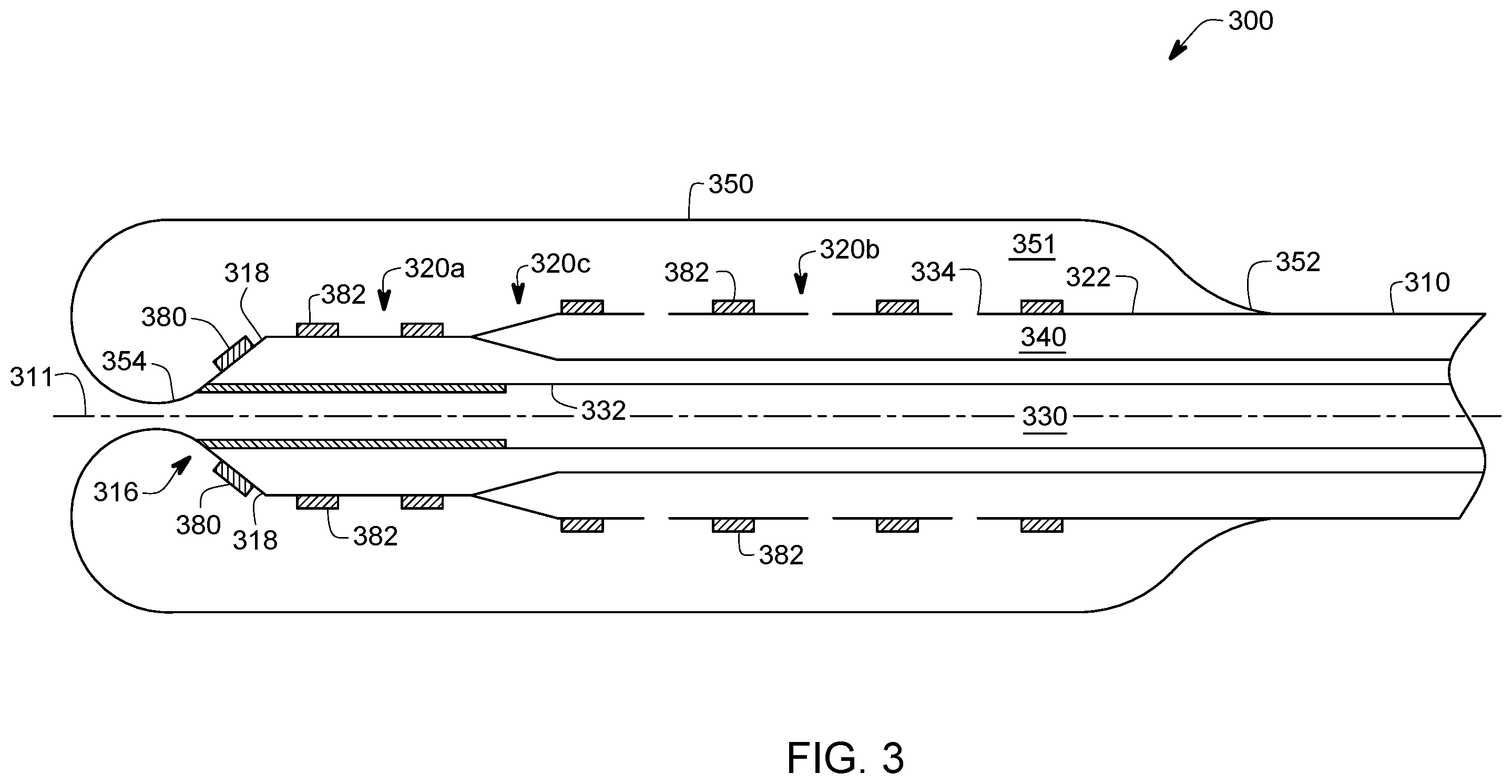 Patent US12551279 Figure 3 – Lithotripsy balloon catheter