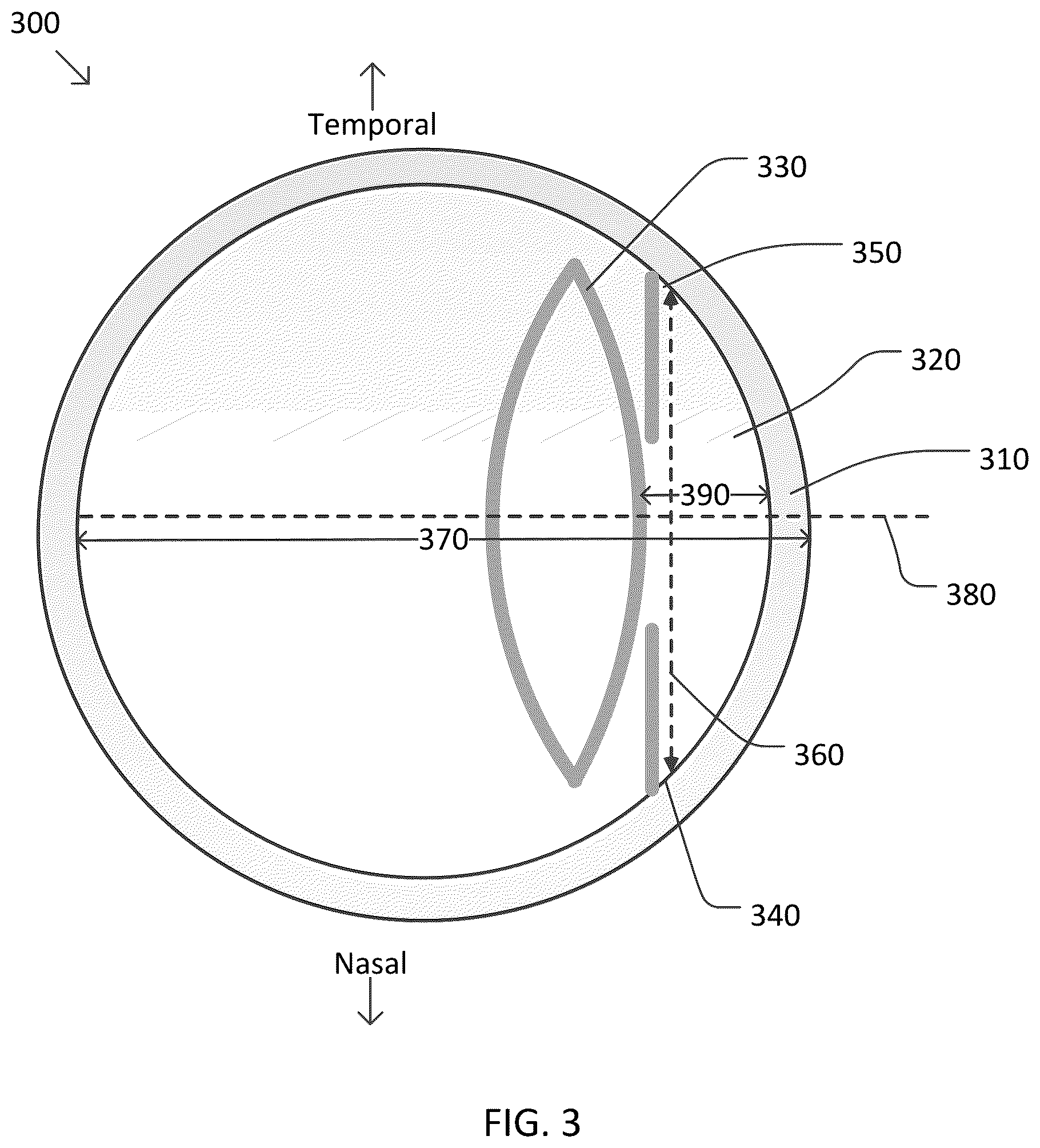 Patent US12551280 Figure 3 – Systems and methods for intraocular lens selection using emmetropia zone prediction