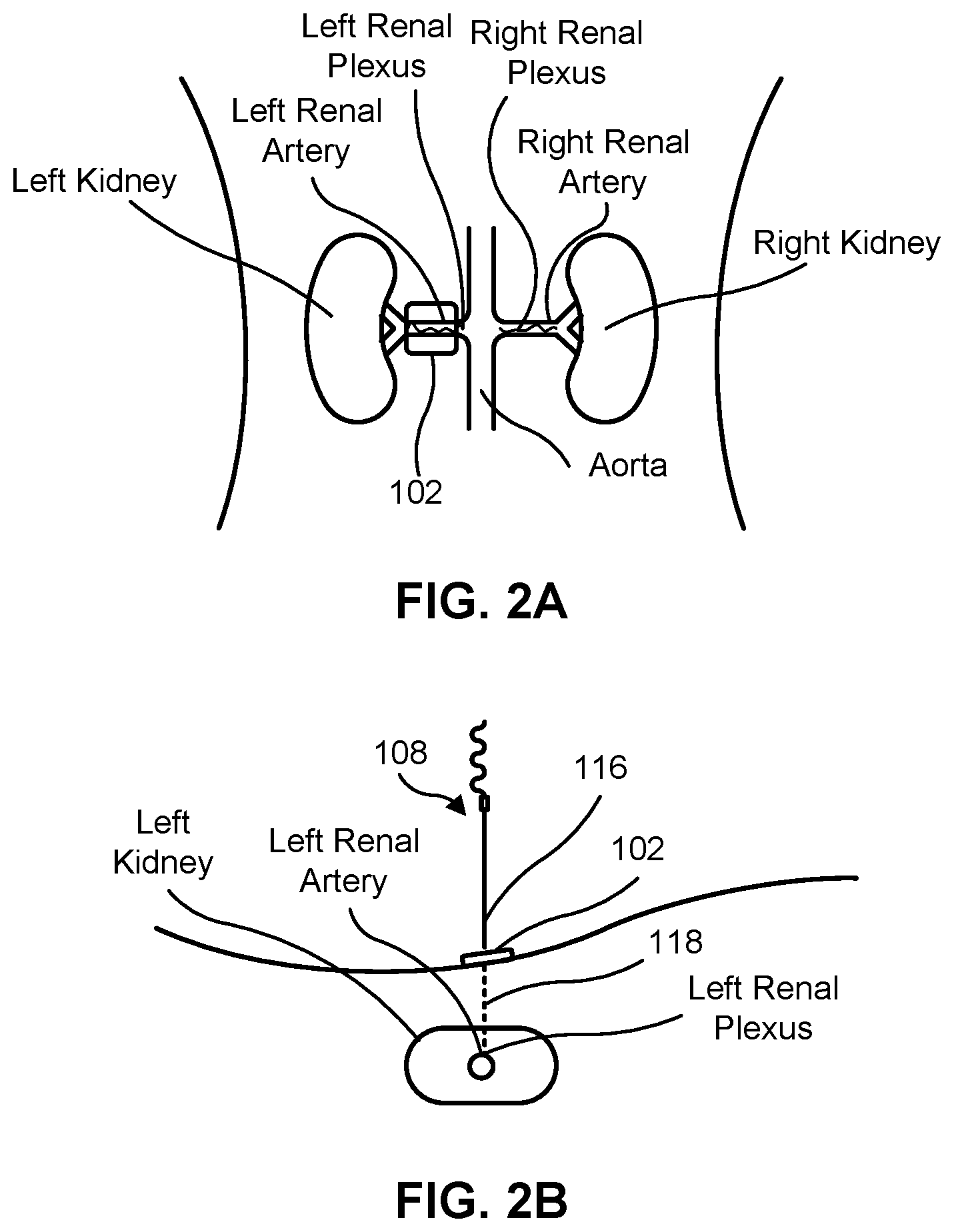Patent US12551282 Figure 2 – Percutaneous medical device navigation system
