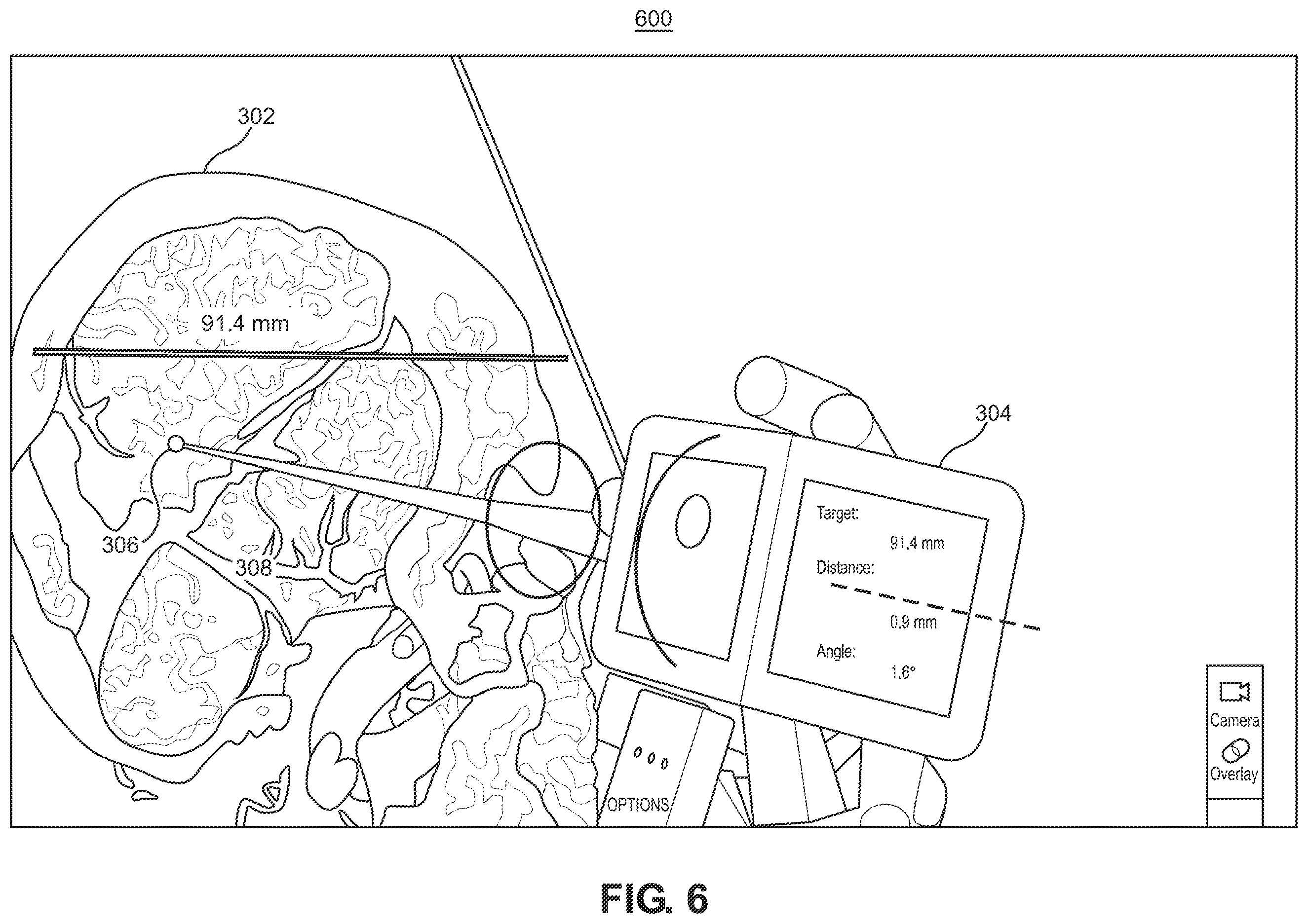 Patent US12551283 Figure 7 – Surgical navigation trajectory in augmented reality display