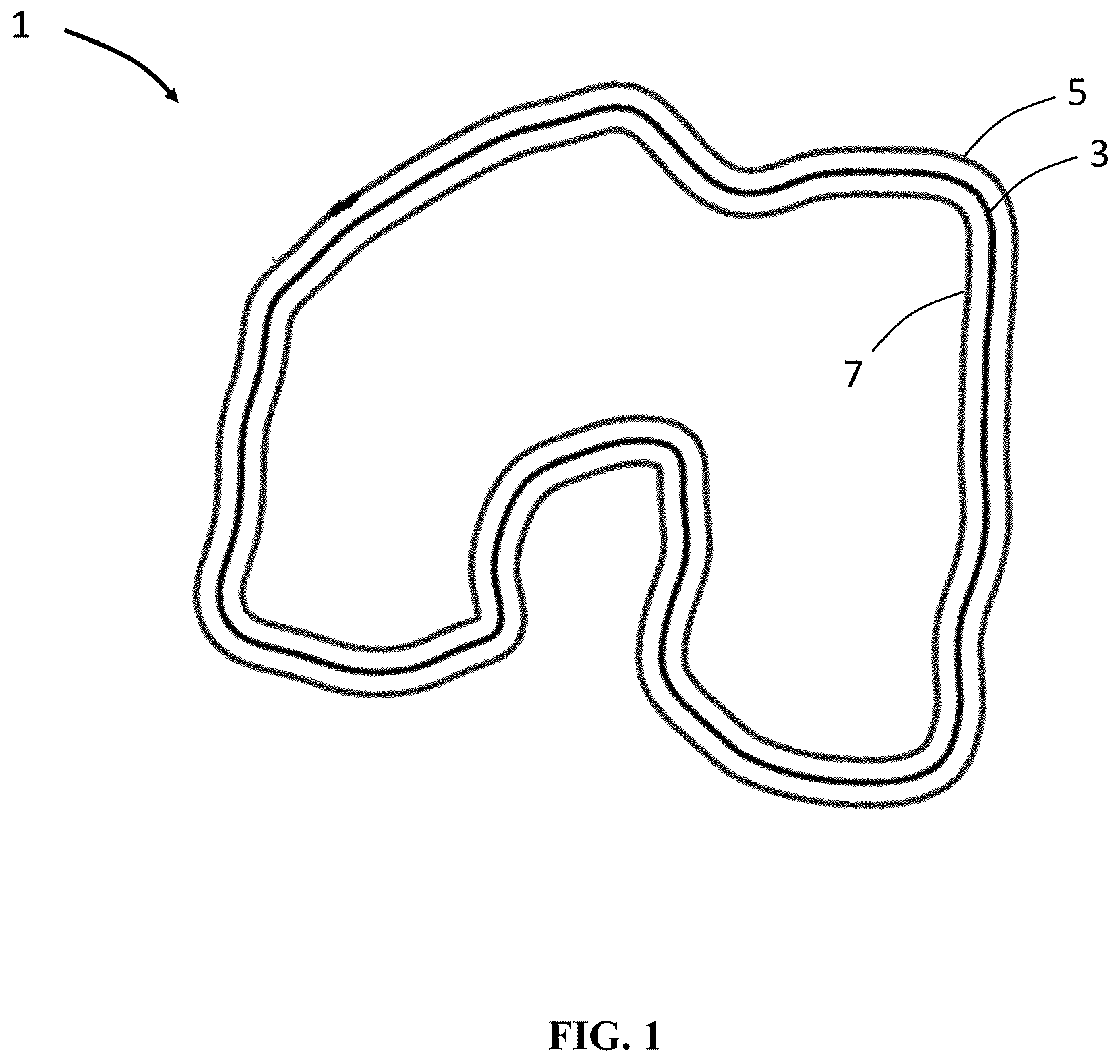 Patent US12551284 Figure 1 – Implant design optimization for geometric uncertainty