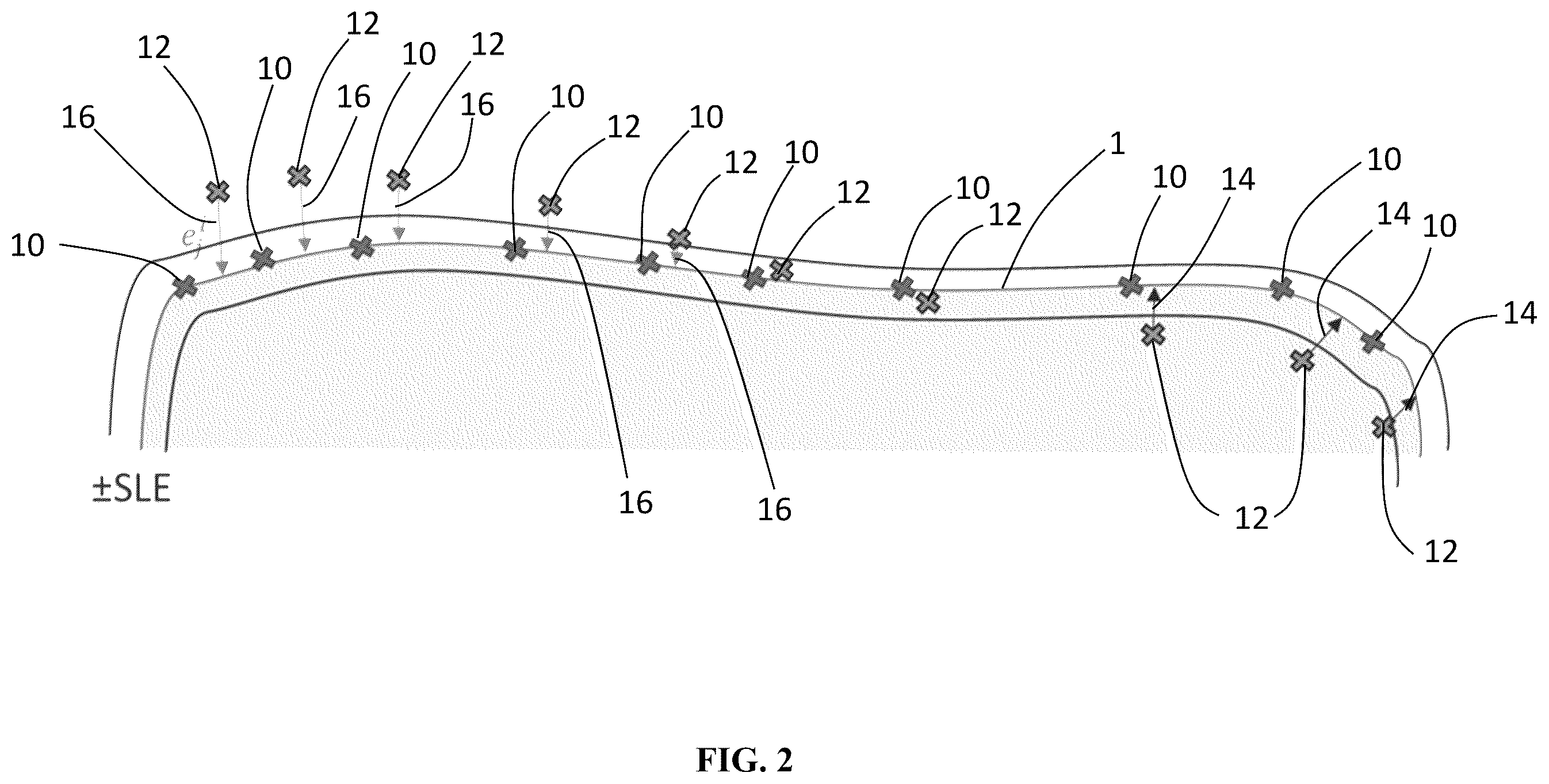 Patent US12551284 Figure 2 – Implant design optimization for geometric uncertainty